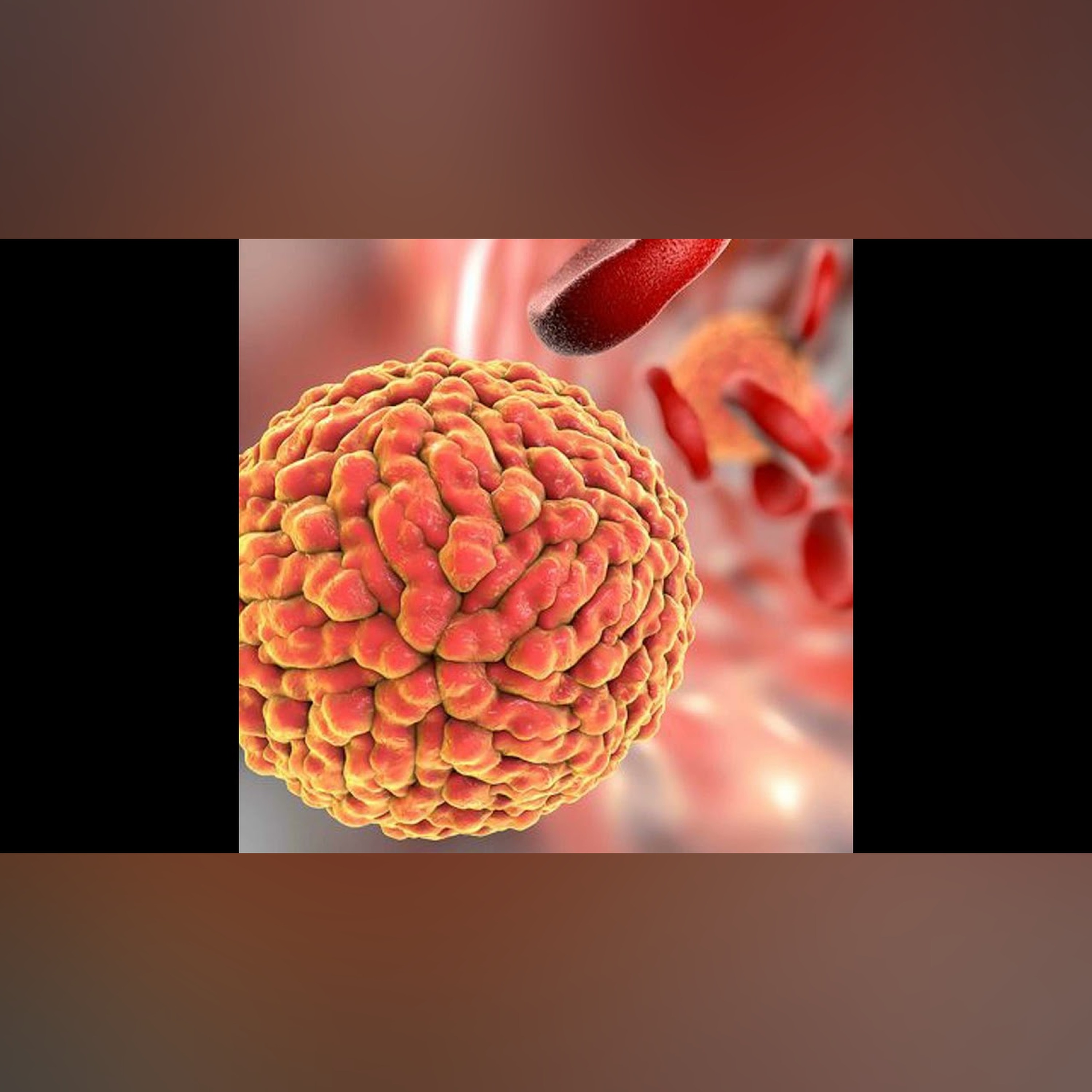 The Changing Impact of Infections as We Go Through Life and Age
