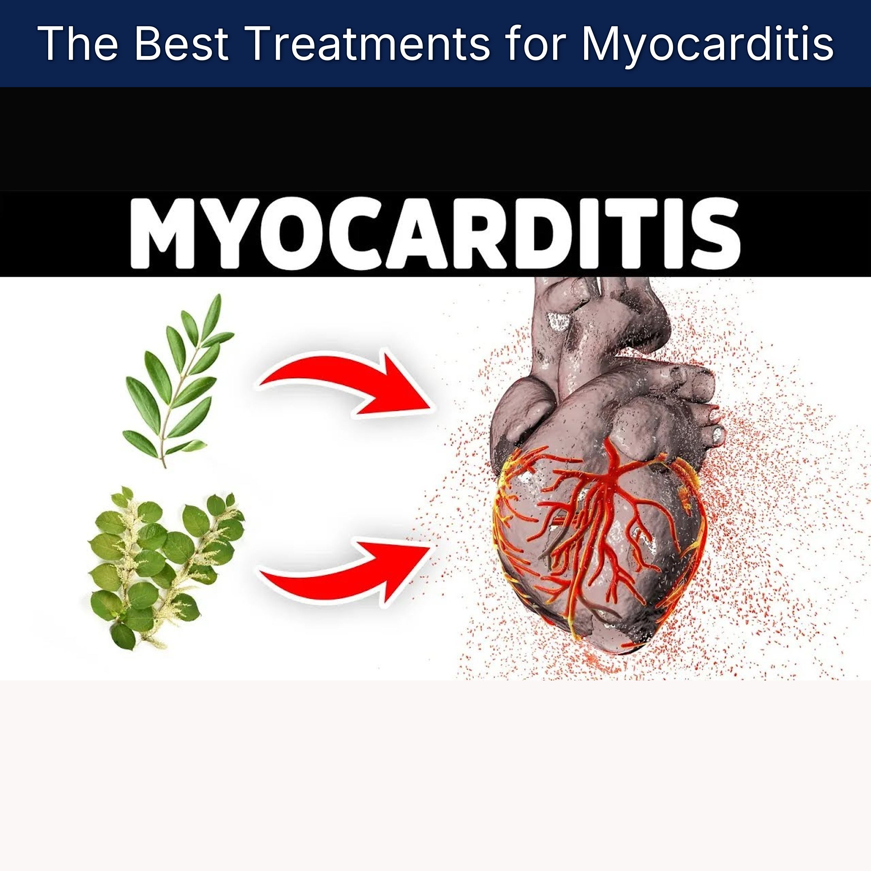The Best Treatments for Myocarditis