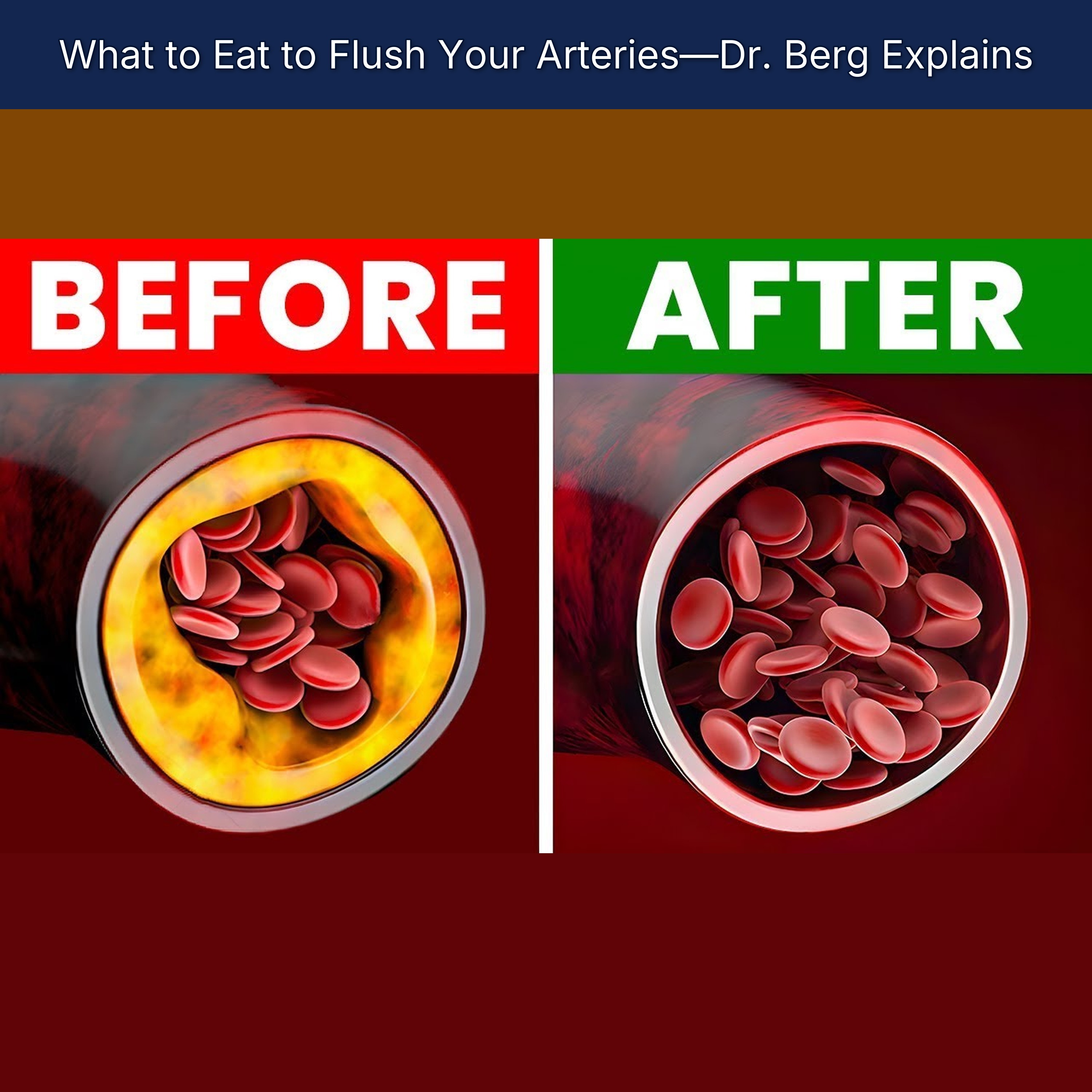 What to Eat to Flush Your Arteries—Dr. Berg Explains episode artwork