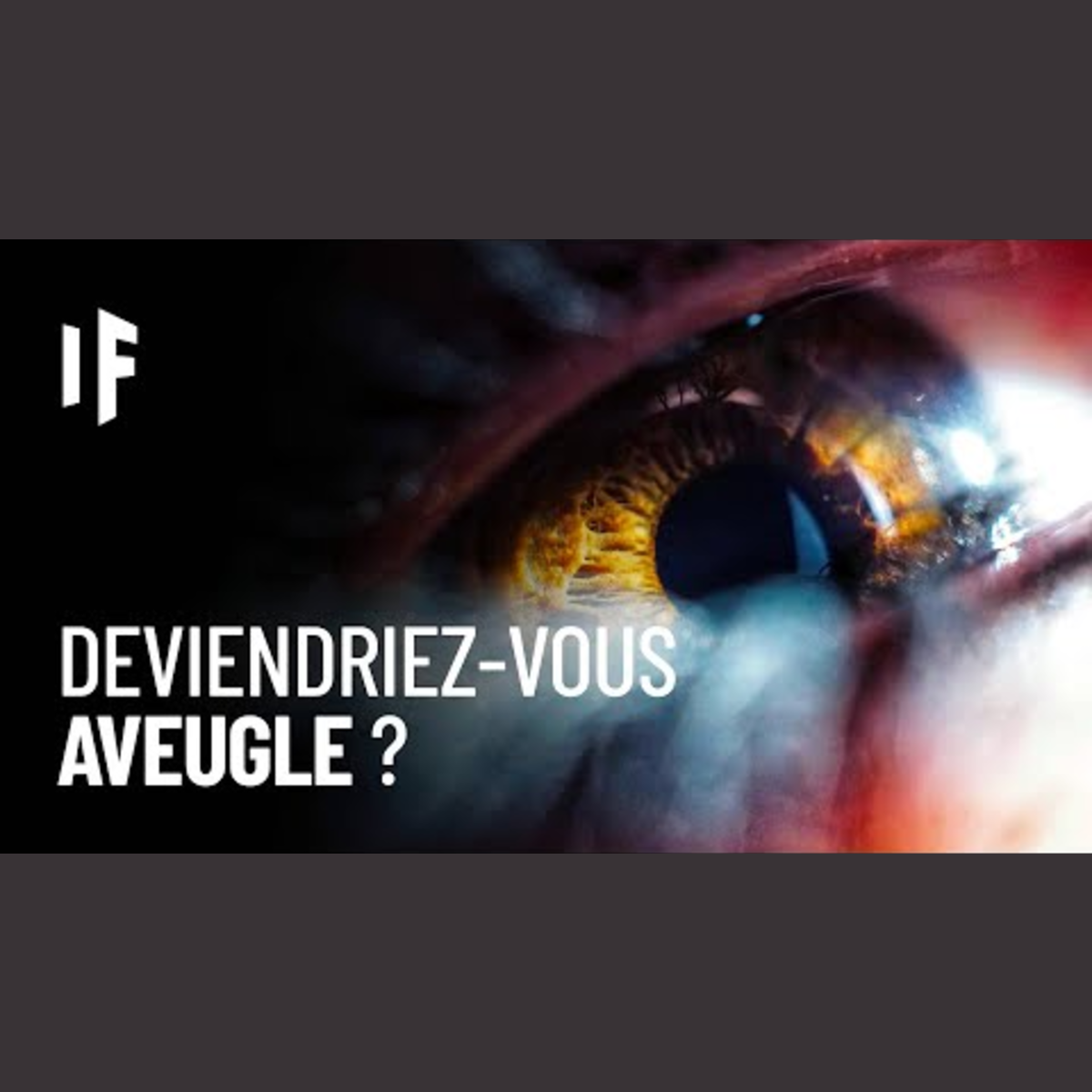 Et si vous n'enleviez jamais vos lentilles ? episode artwork