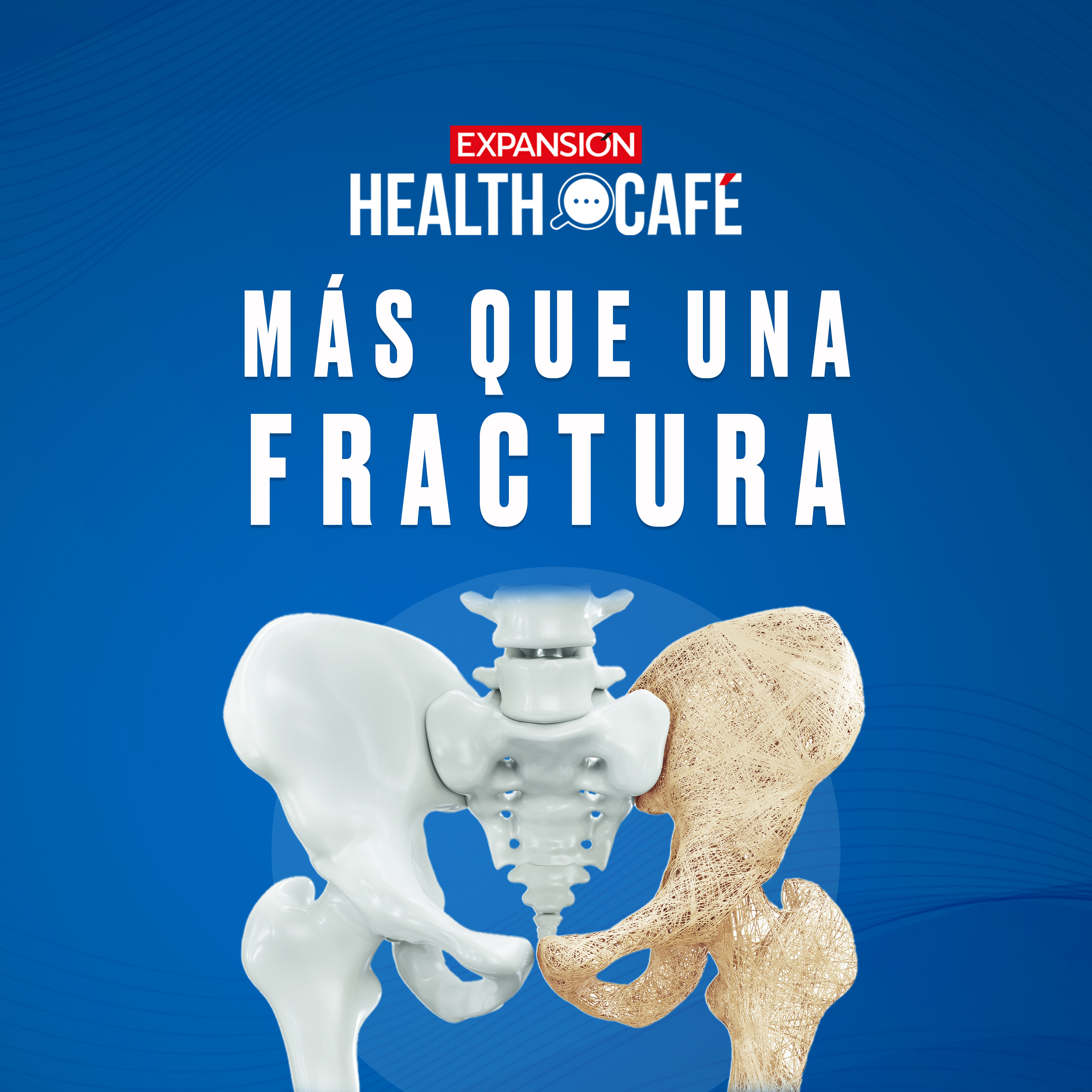 Osteoporosis: ¿Cómo cuidar tus huesos? | Health Café episode artwork