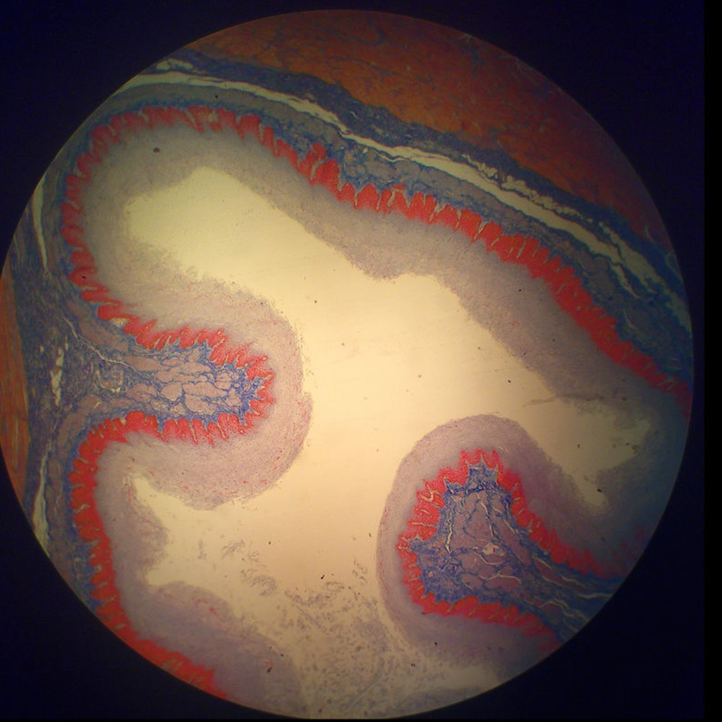 Mutant cells in the esophagus, and protecting farmers from dangerous pesticide exposure