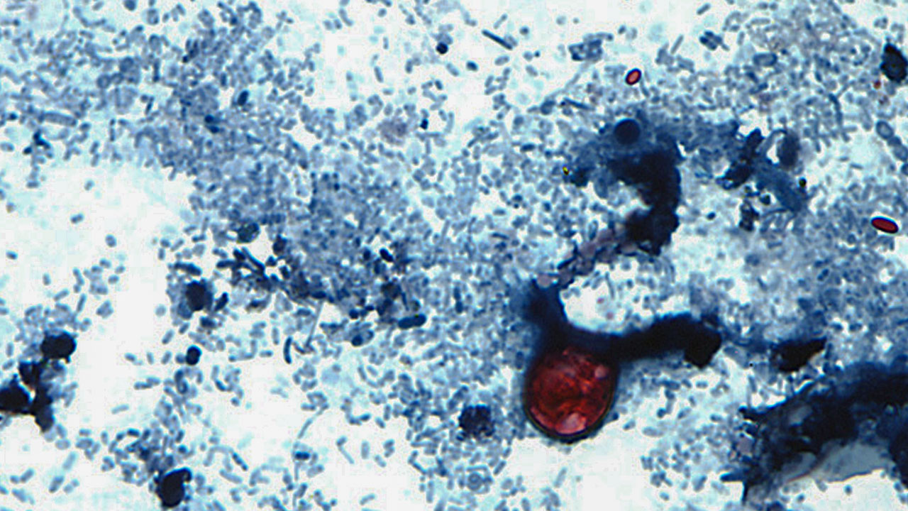 Why tracing cyclosporiasis is so tough, and a digestible probe for the microbiome