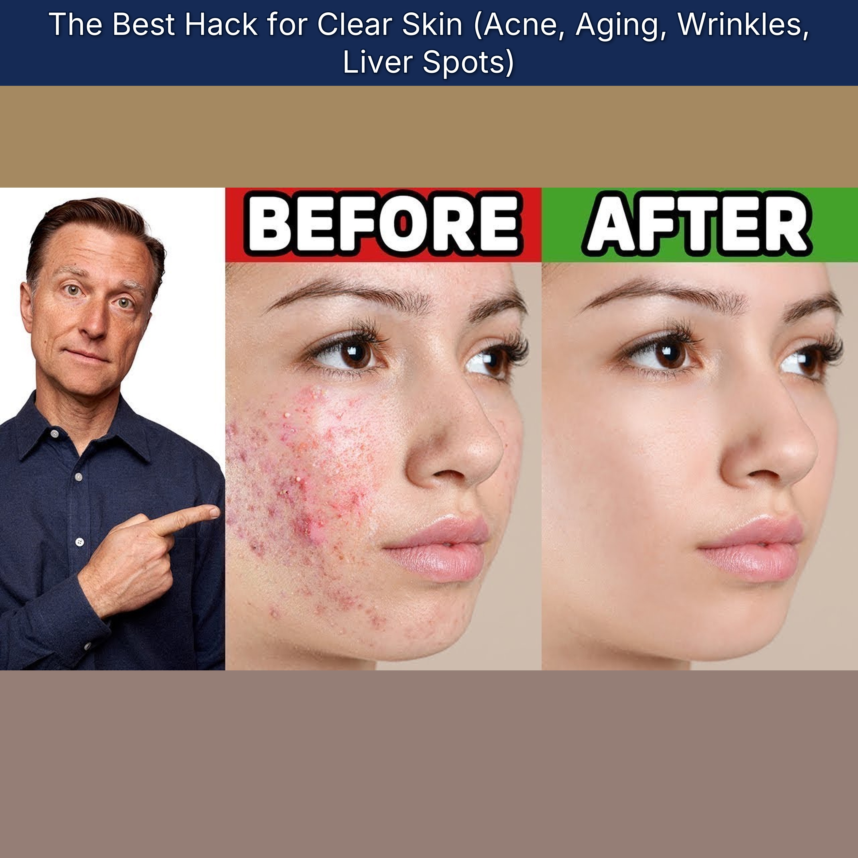 The Best Hack for Clear Skin (Acne, Aging, Wrinkles, Liver Spots)