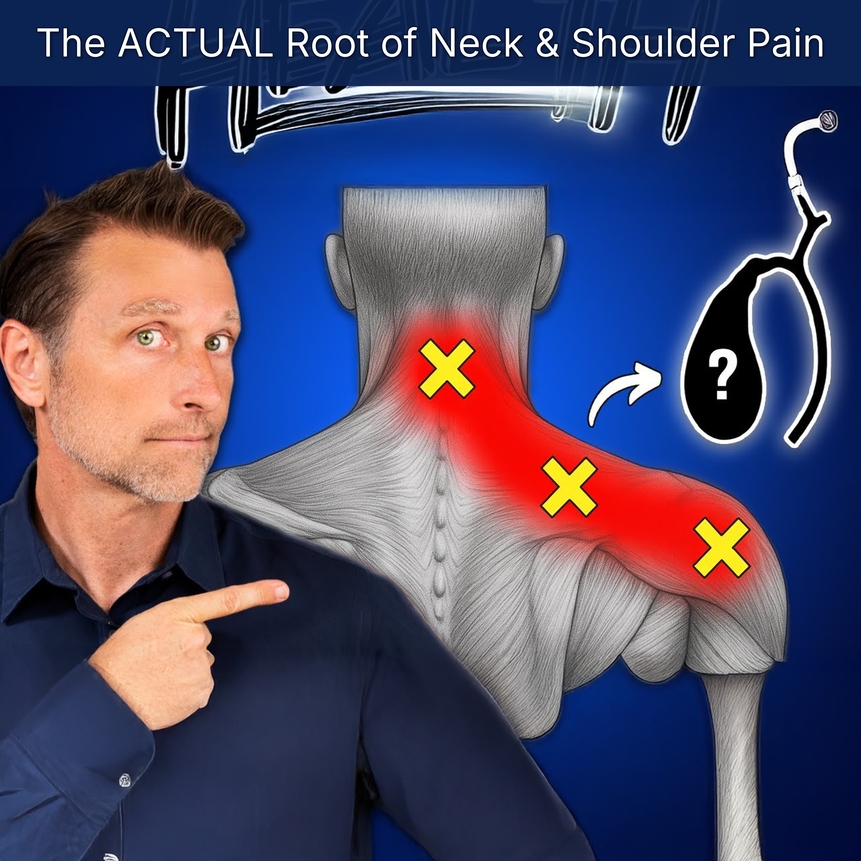 The ACTUAL Root of Neck & Shoulder Pain