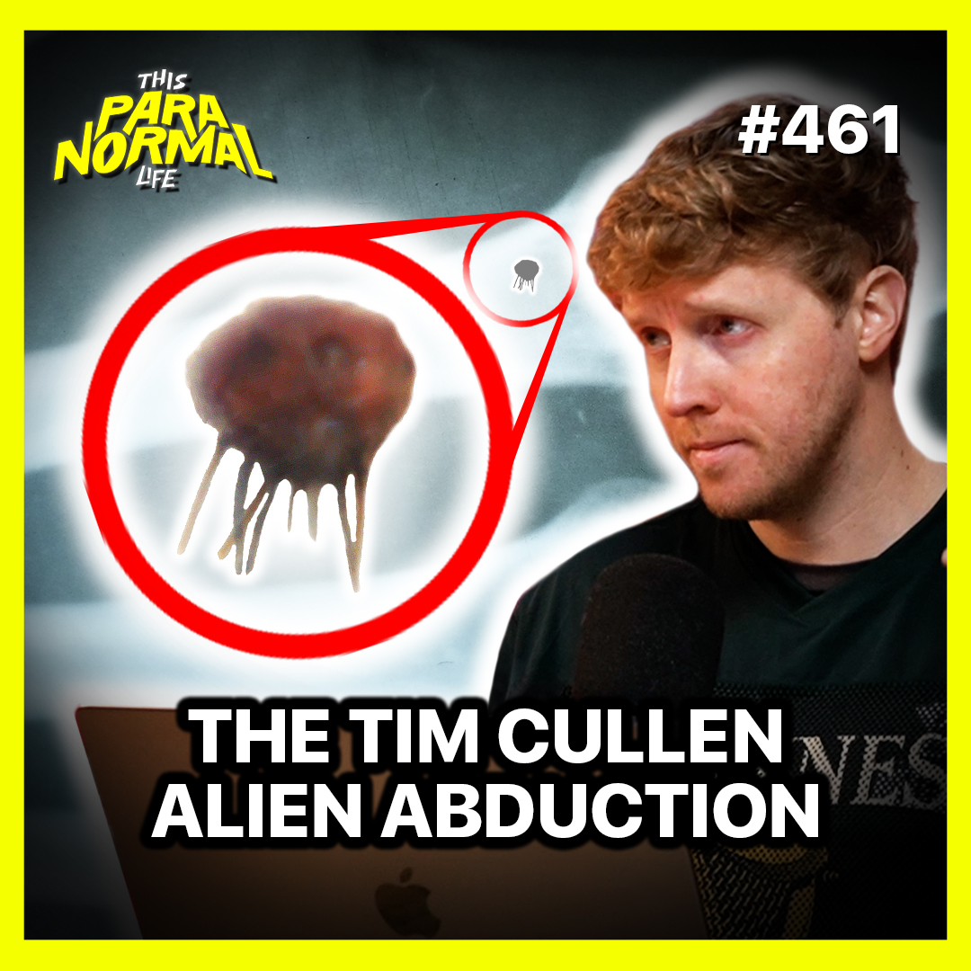 Man Discovers Strange Alien Implant in His Arm