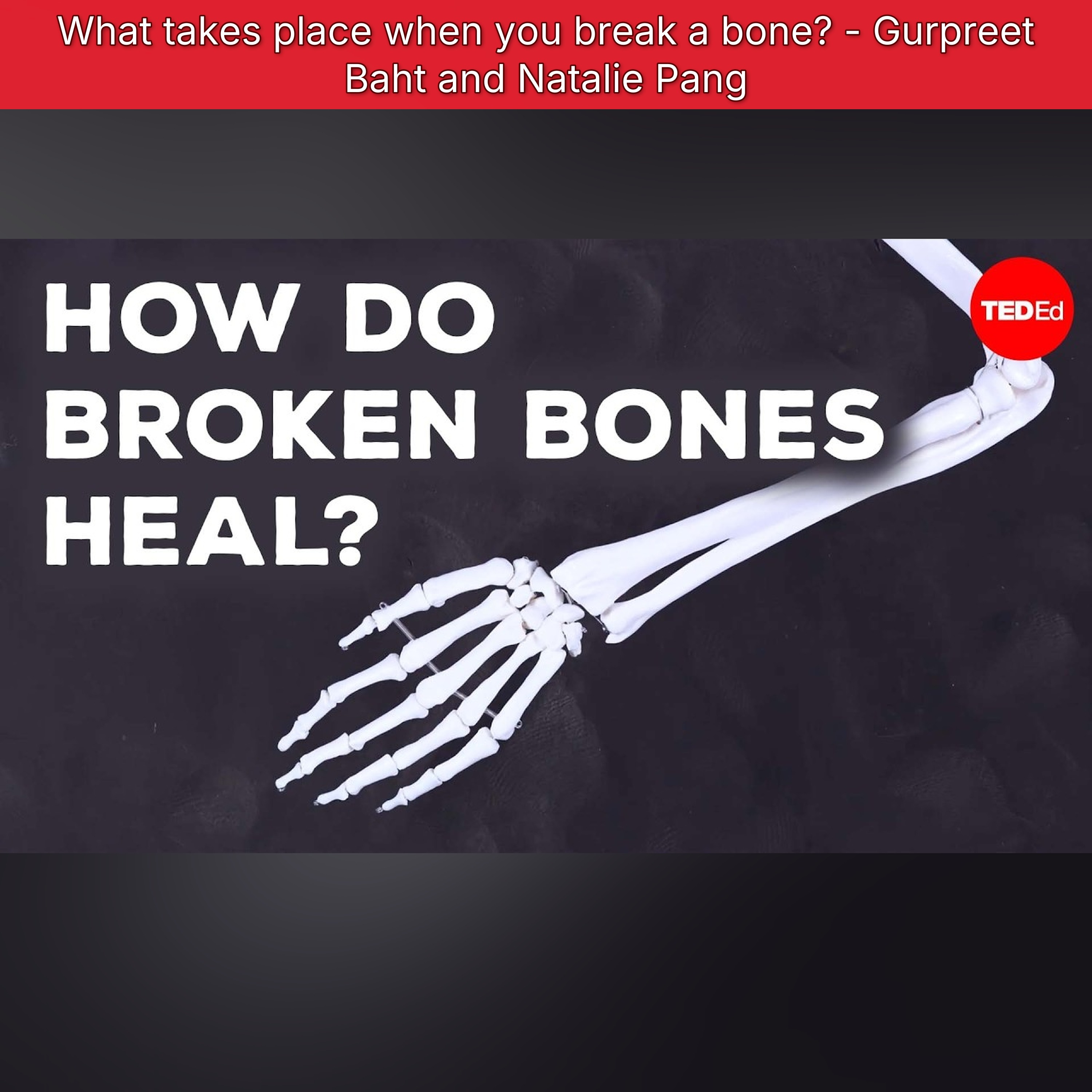 What takes place when you break a bone? - Gurpreet Baht and Natalie Pang