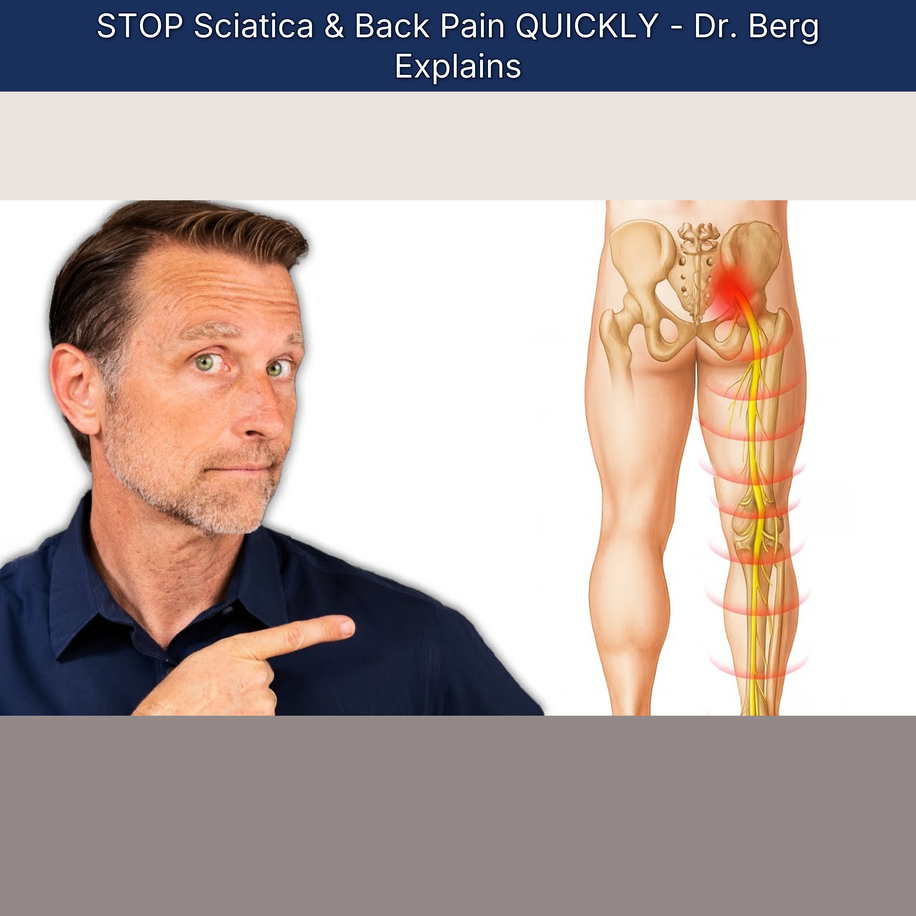 STOP Sciatica & Back Pain QUICKLY - Dr. Berg Explains