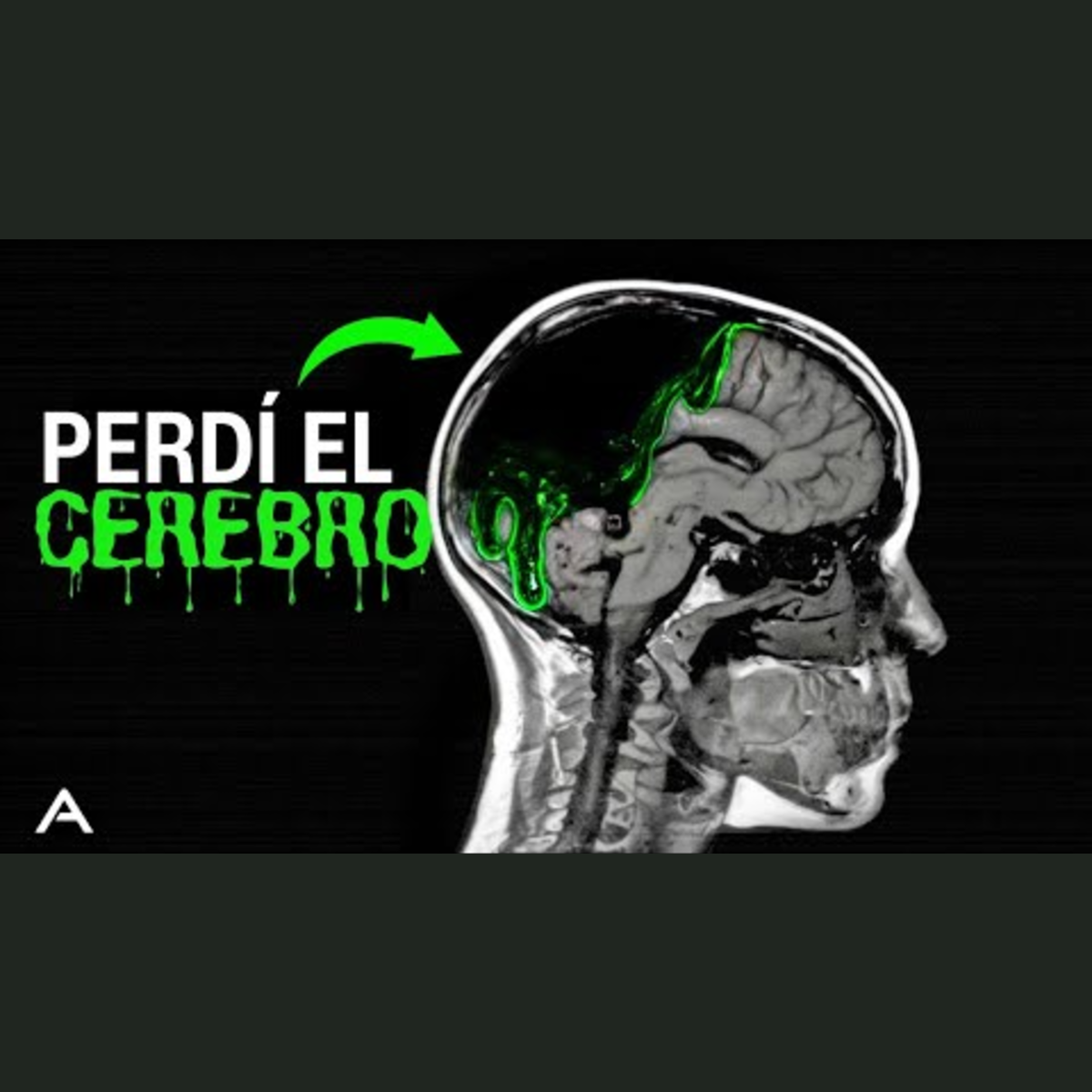 El daño cerebral causado por pantallas es PEOR de lo que piensas