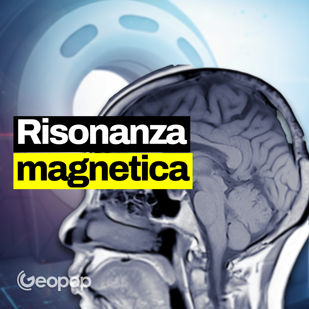 293 - Cosa succede al nostro corpo durante una risonanza magnetica?