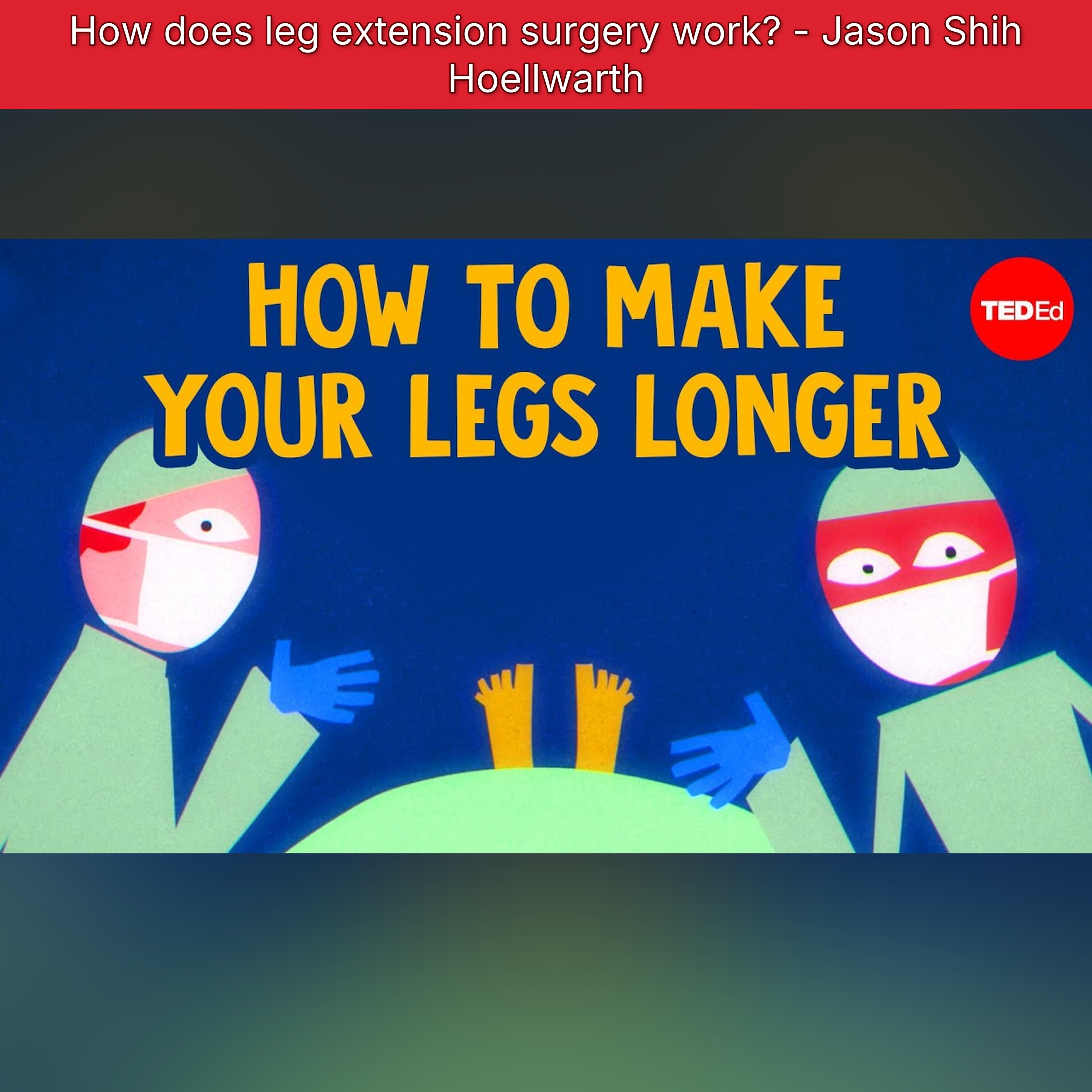 How does leg extension surgery work? - Jason Shih Hoellwarth episode artwork