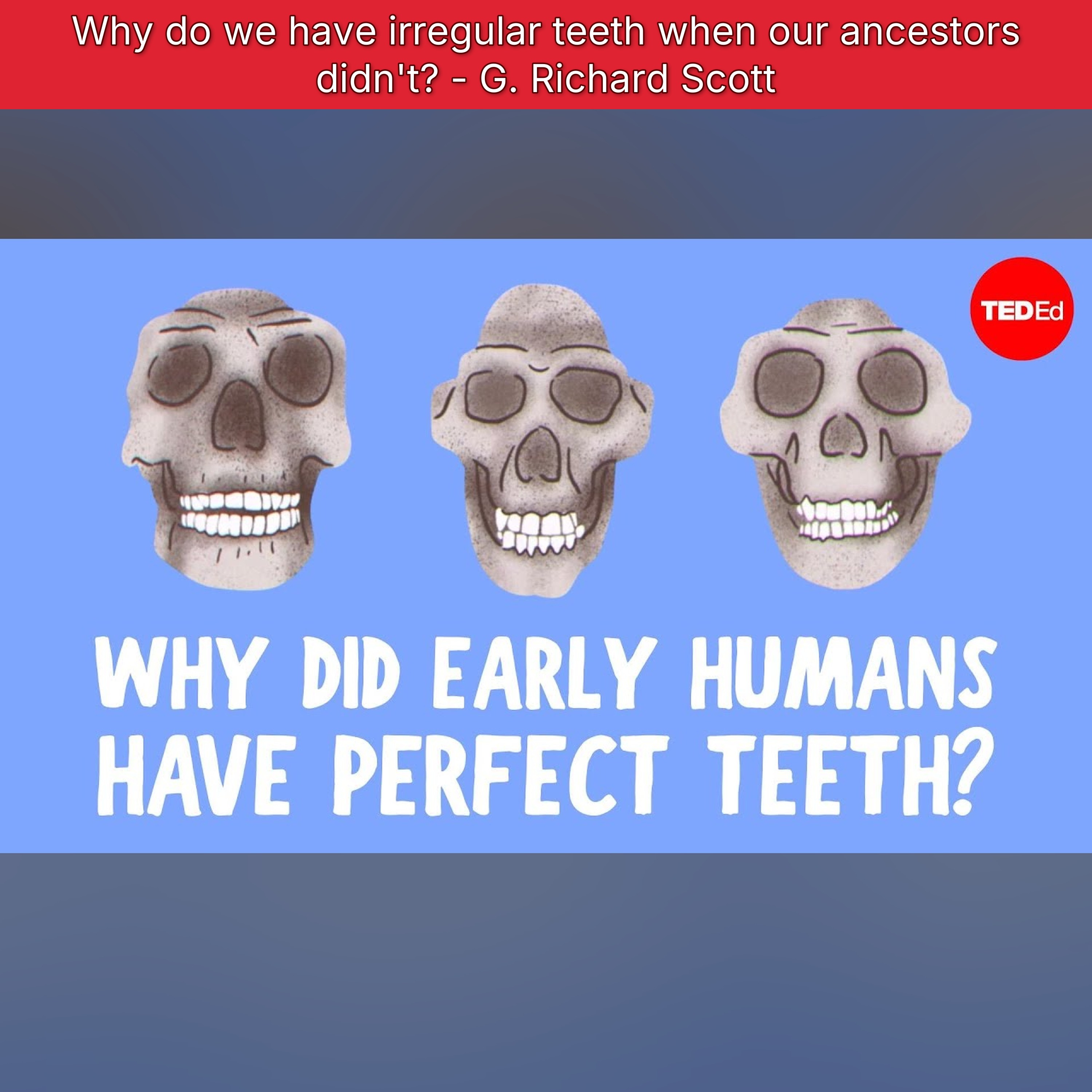 Why do we have irregular teeth when our ancestors didn't? - G. Richard Scott episode artwork
