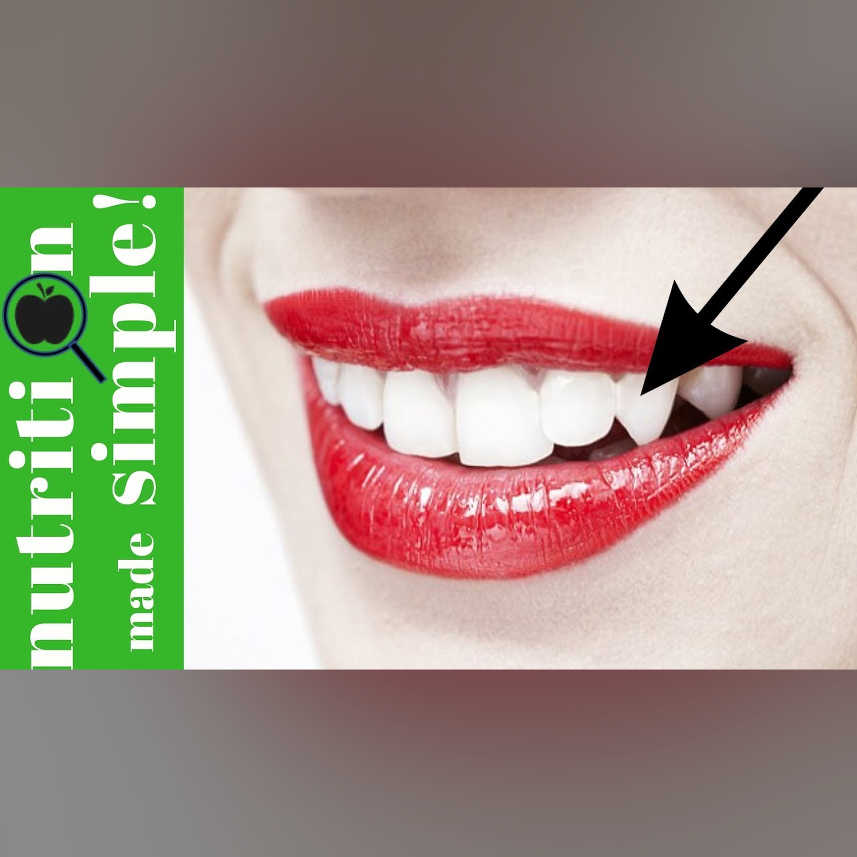 Human canines and dietary choices | #Keep’n it simple