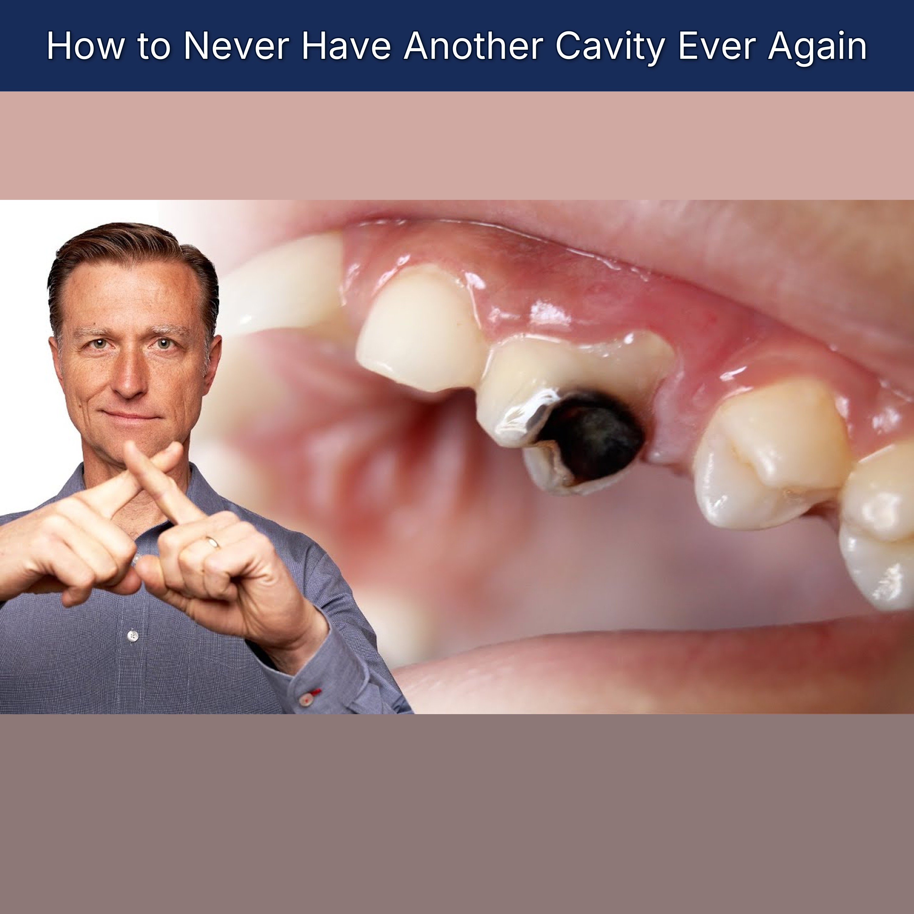 How to Never Have Another Cavity Ever Again