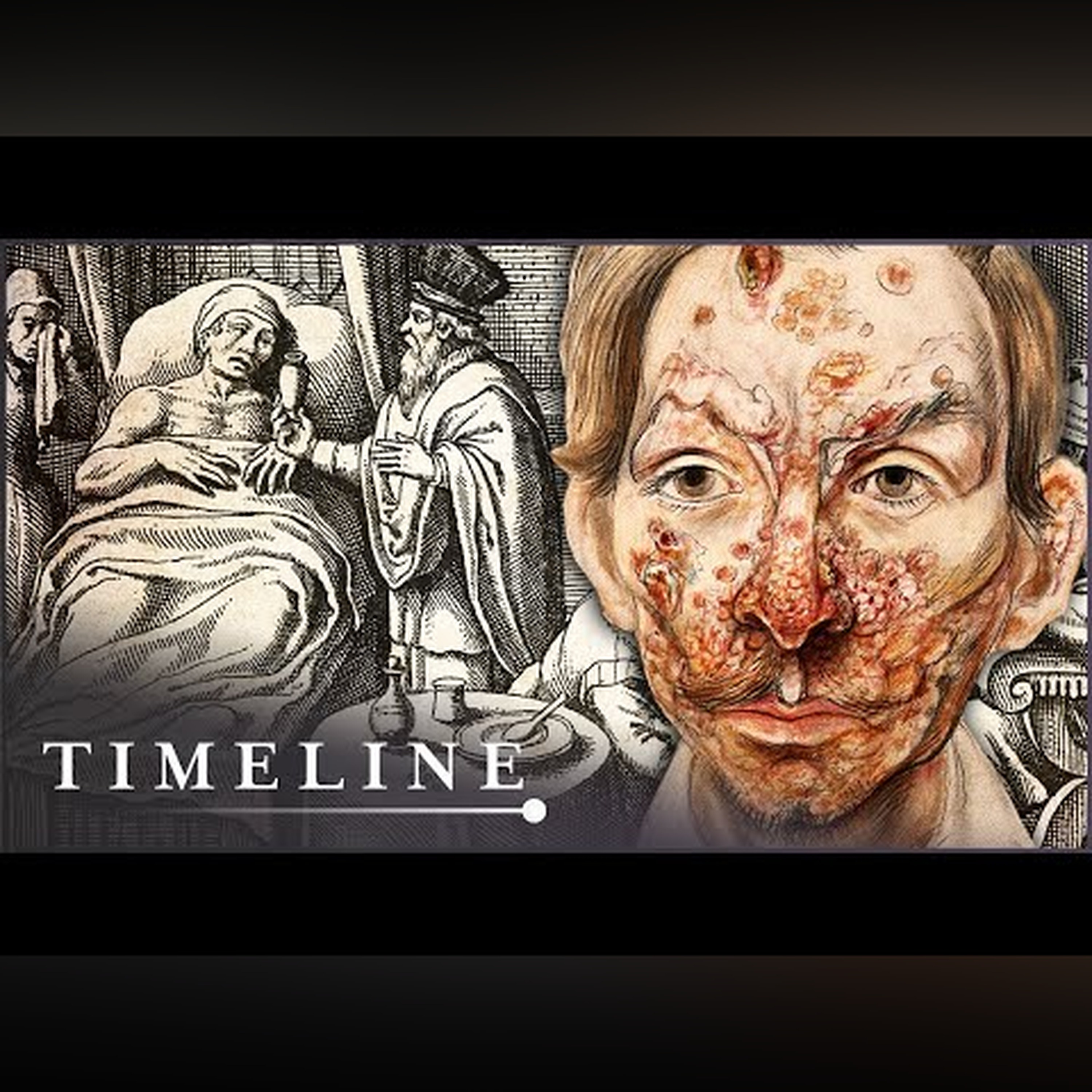 The True Terrors Of Tudor Medicine | Hidden Killers | Timeline episode artwork
