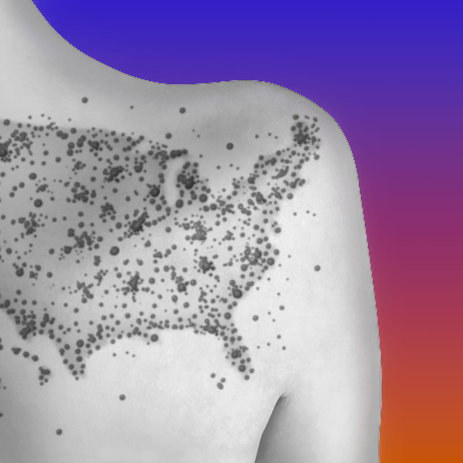 What Next: TBD | Hot Measles Summer