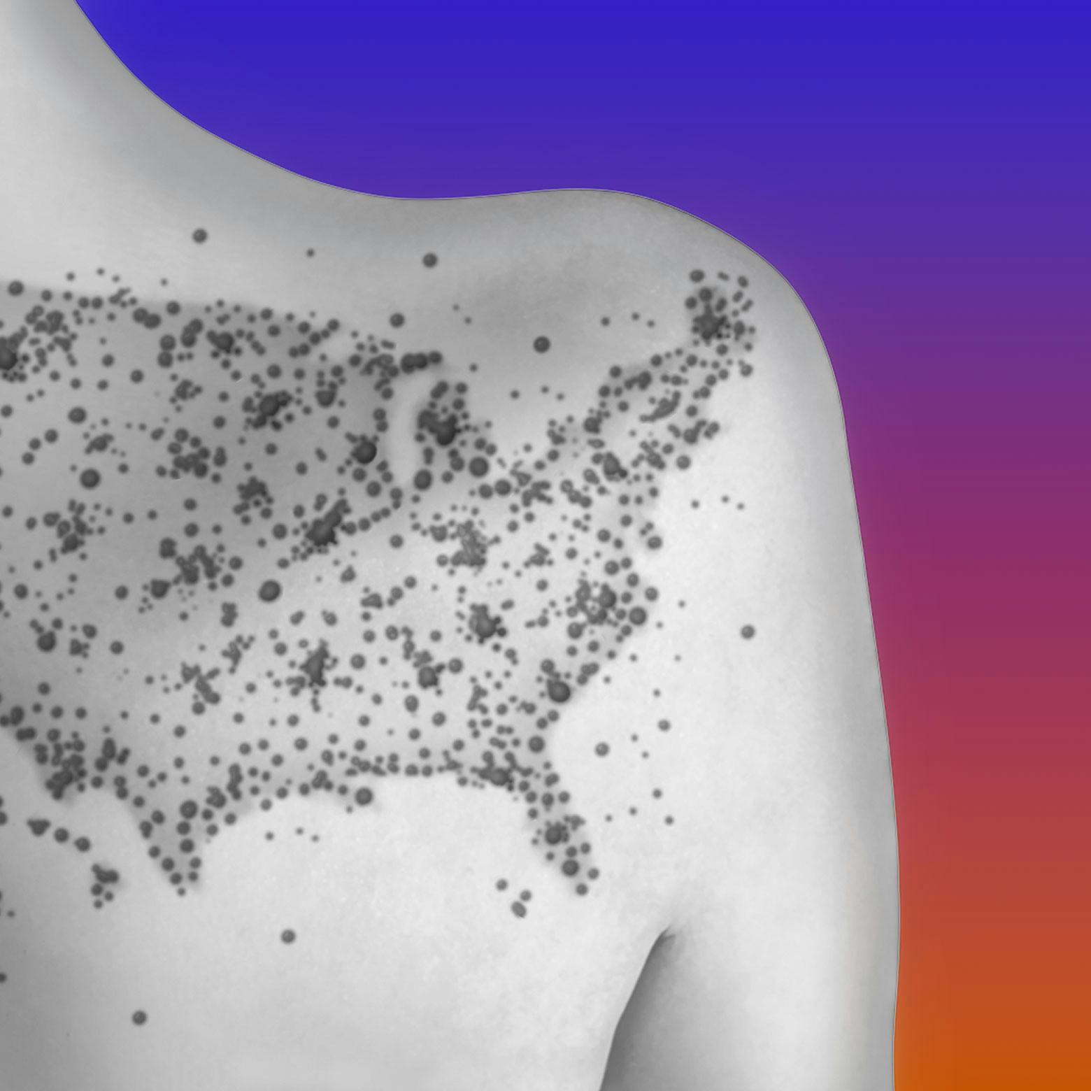 What Next: TBD | Hot Measles Summer What Next: TBD | Hot Measles Summer