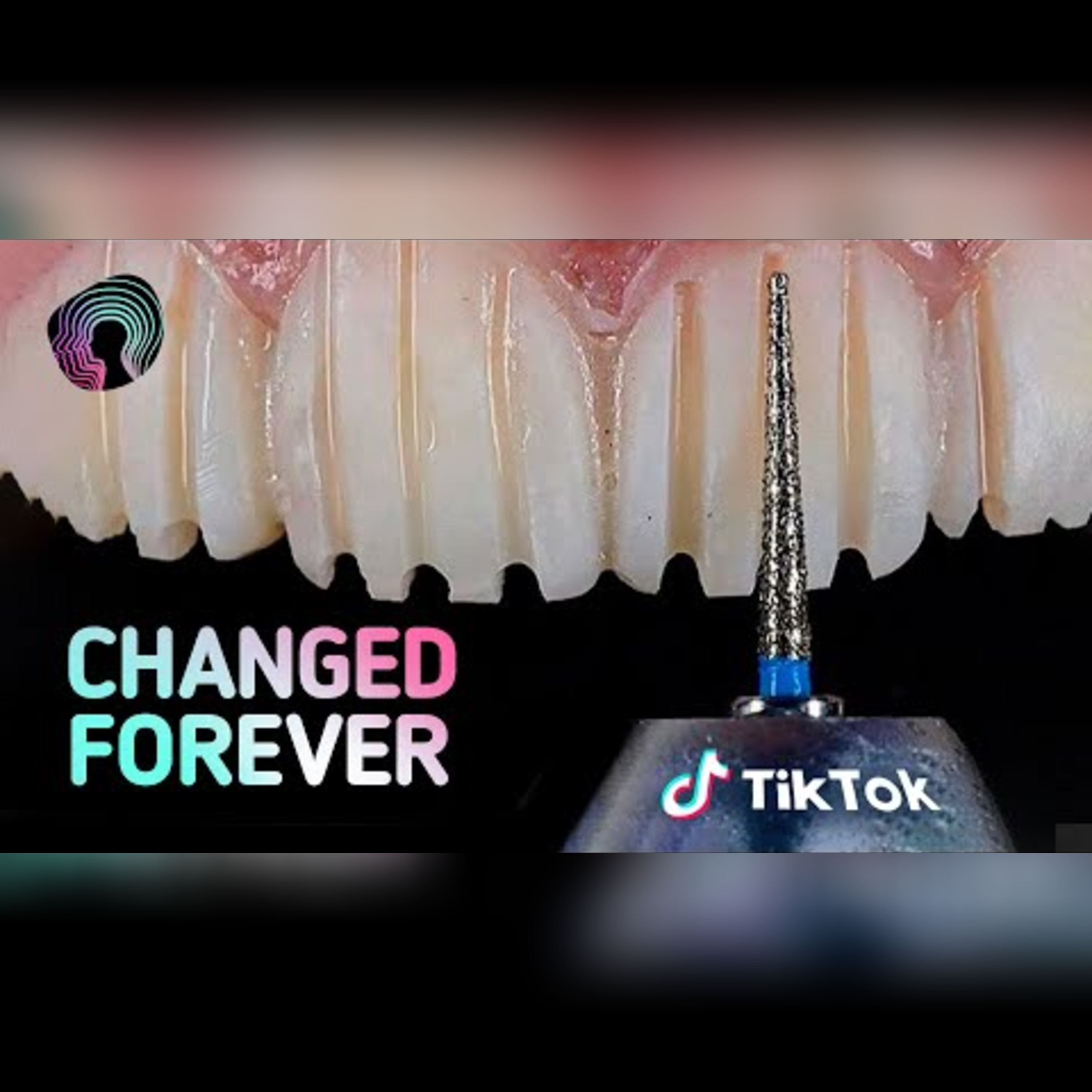 Unveiling the TikTok Veneer Craze: Essential Insights episode artwork