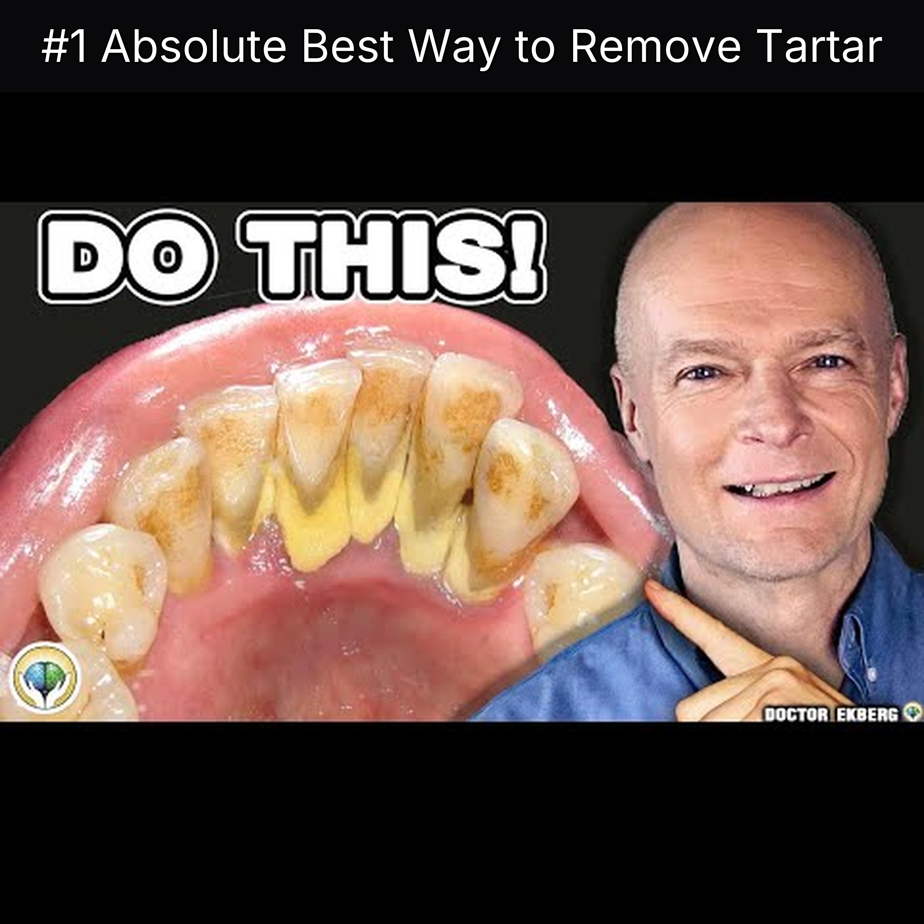#1 Absolute Best Way to Remove Tartar episode artwork