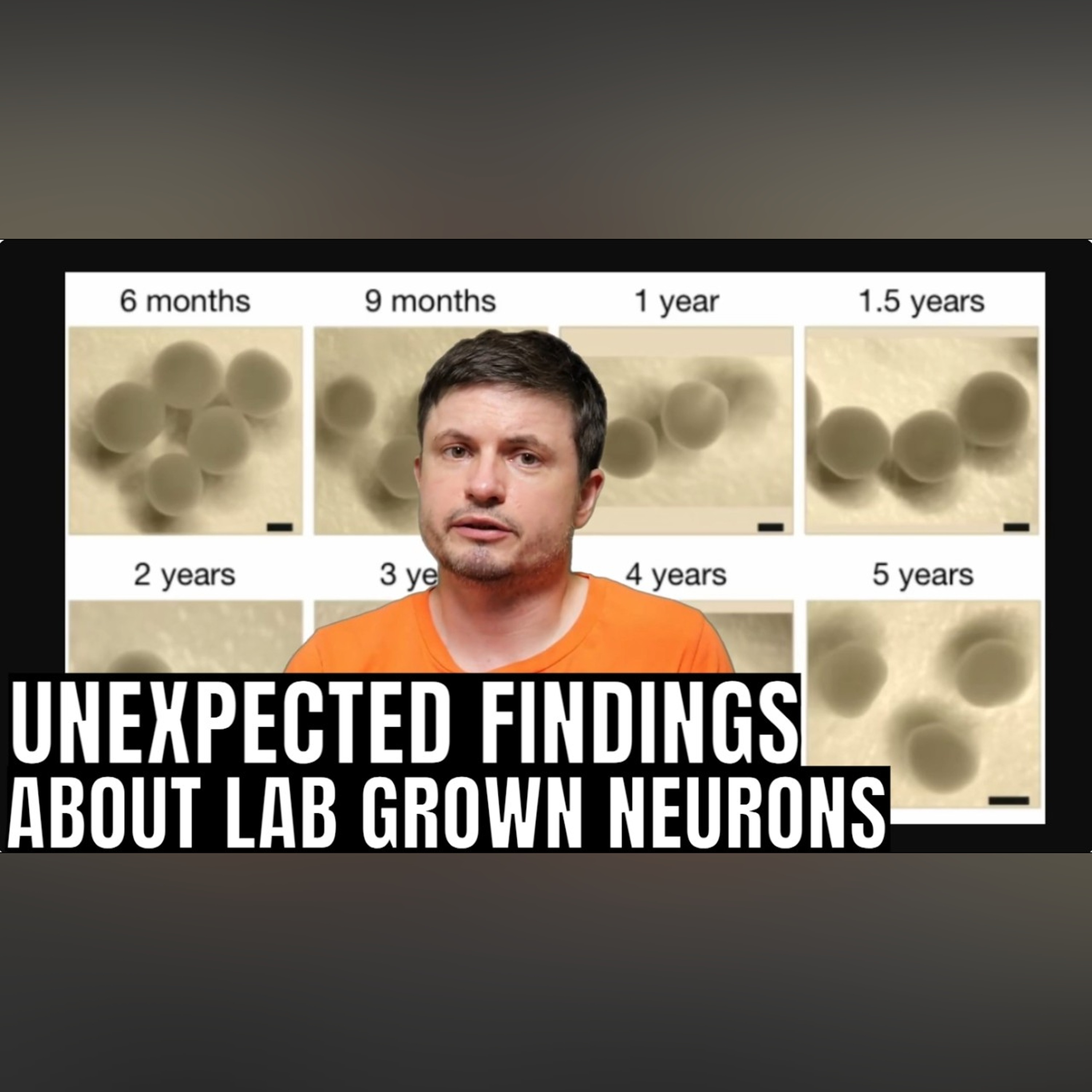 Lab-Grown Human Brain Cells Can Sense Time and Direction