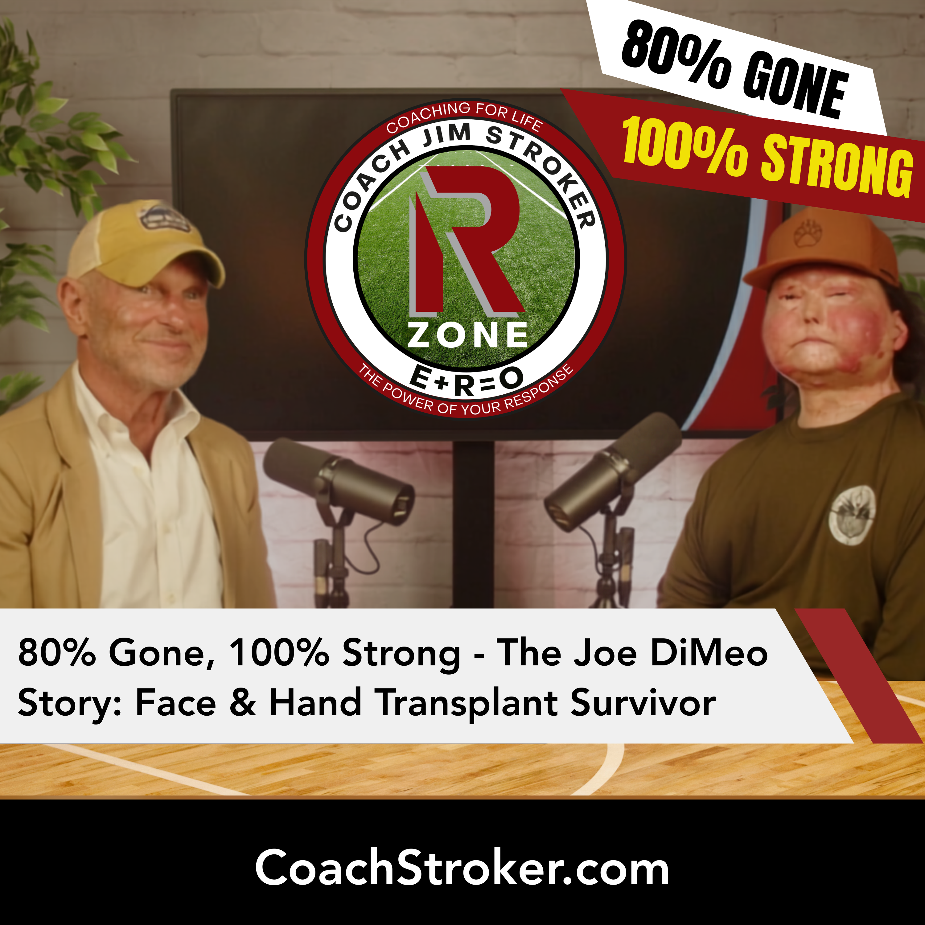 80% Gone, 100% Strong - The Joe DiMeo Story: Face & Hand Transplant Survivor episode artwork