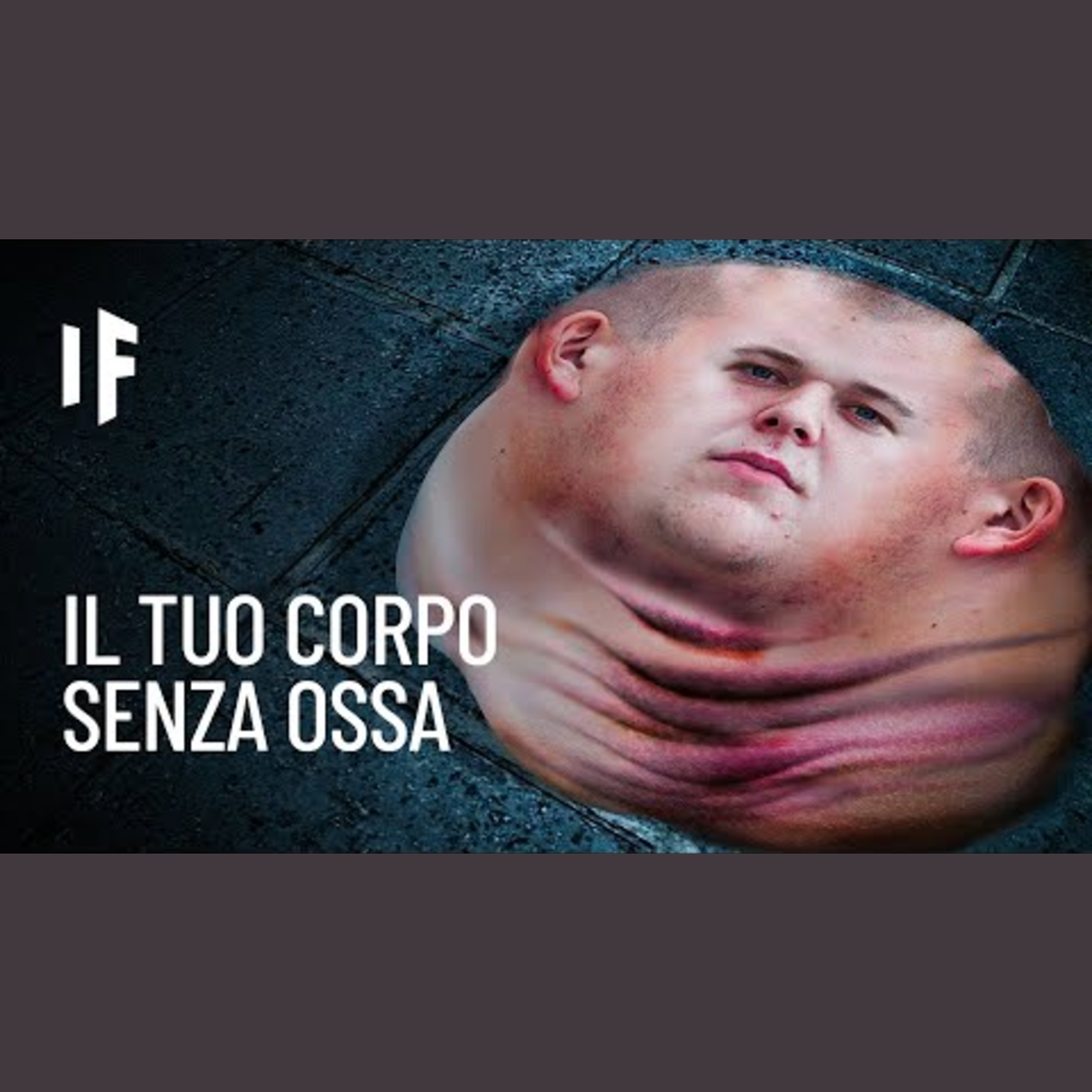 E se non avessimo le ossa? episode artwork