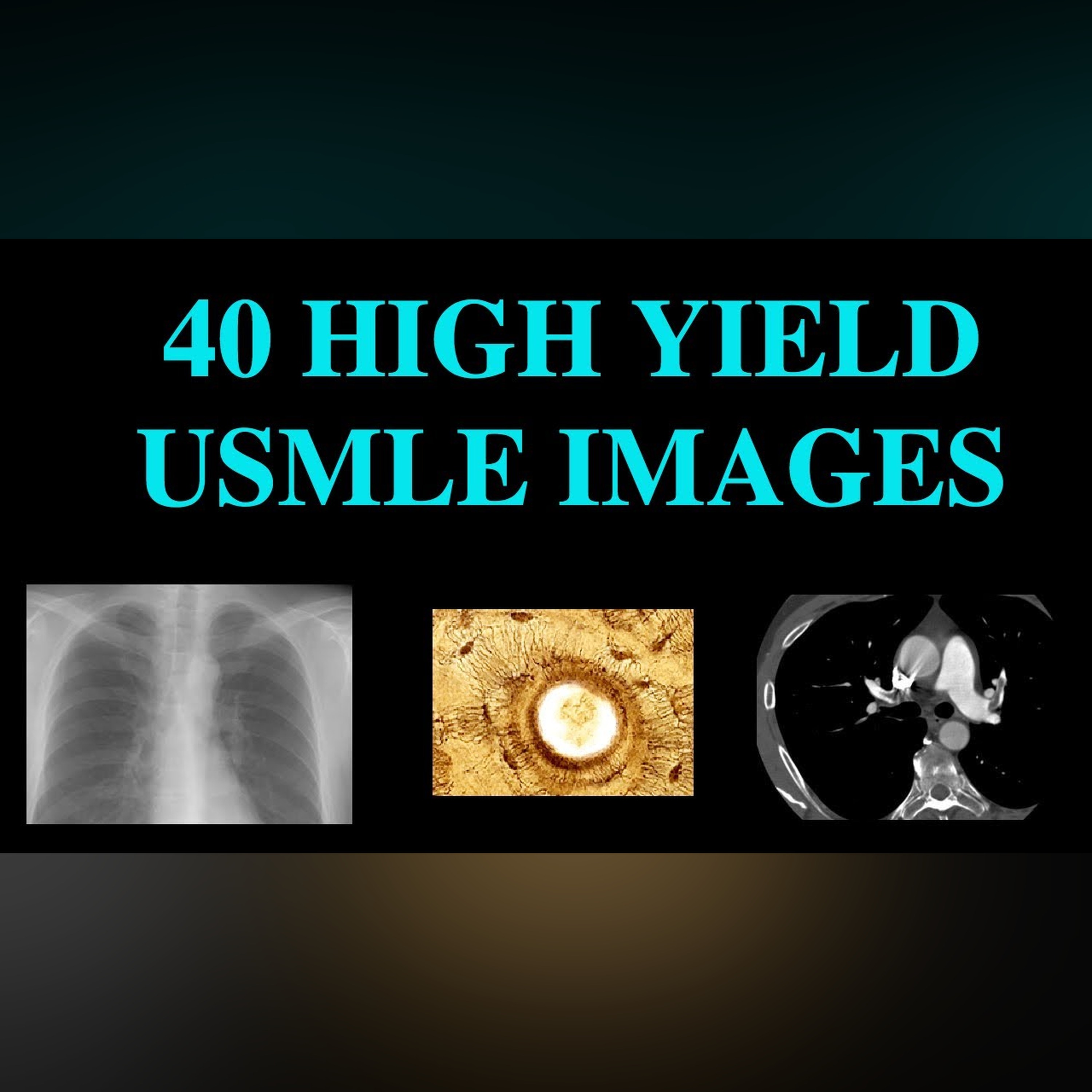 40 High Yield Images for USMLE (CT, XRay, Histology) episode artwork