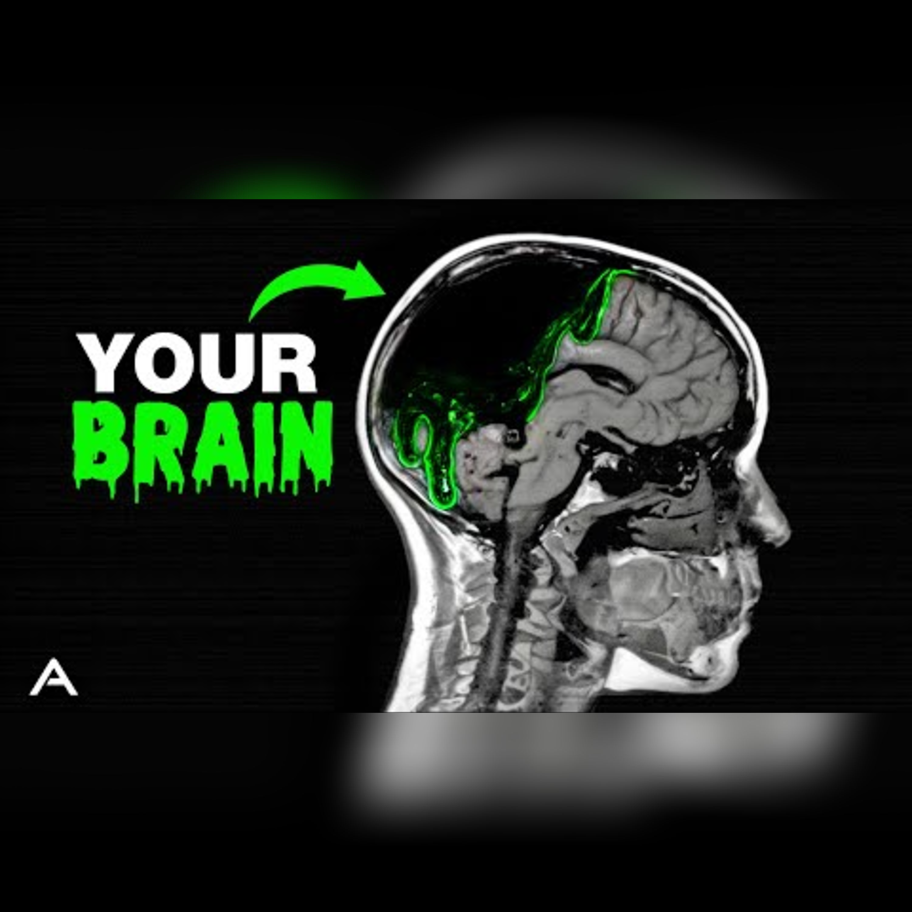 The Truth About Brain Rot: The Reality Is Worse Than Imagined