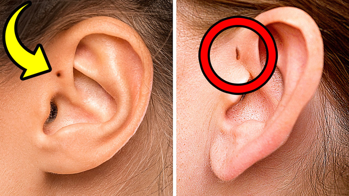 Your Ears May Reveal How Rare You Are + 10 Unique Body Features