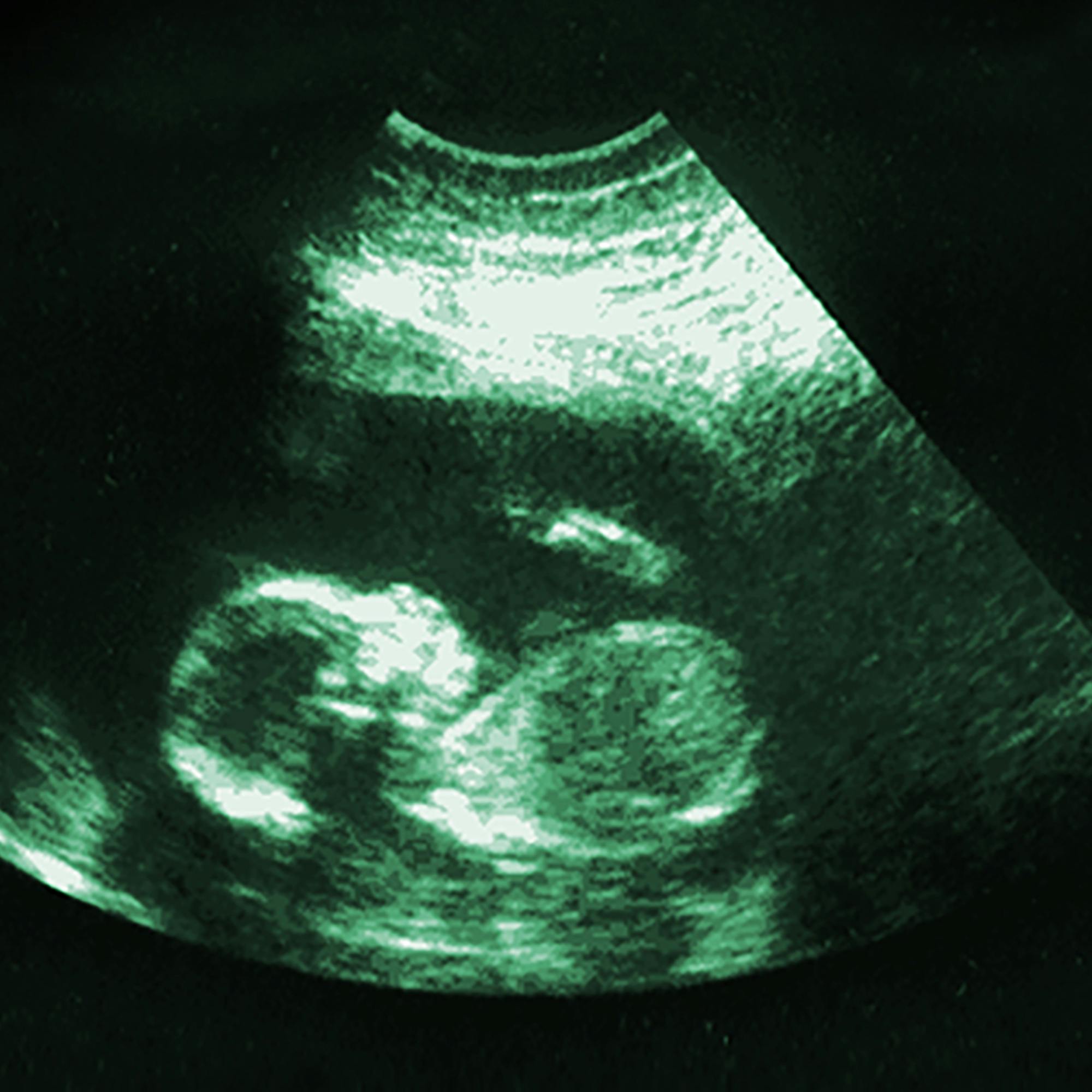 Thumbnail for "Biological Clock". Thumbnail for "Biological Clock".