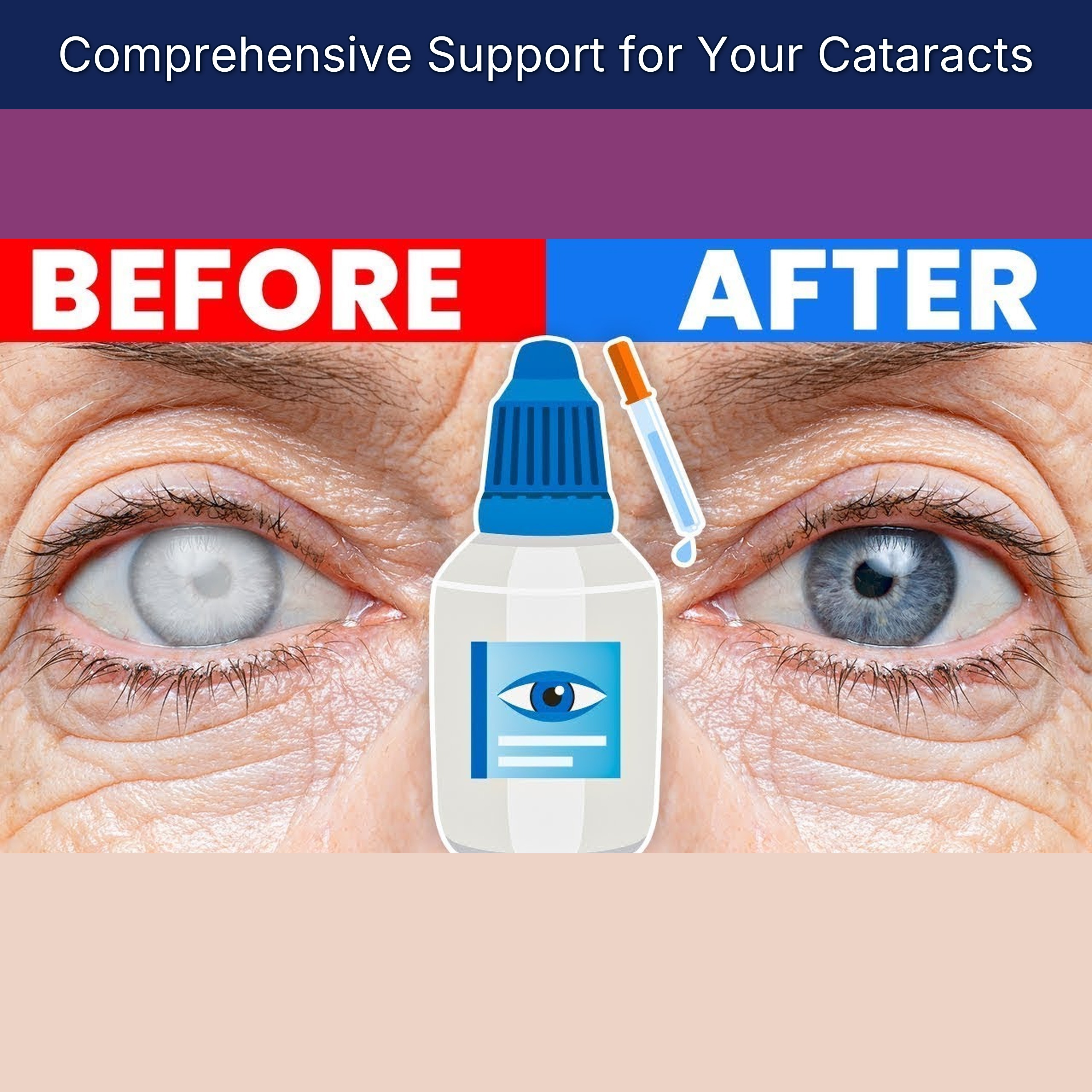 Comprehensive Support for Your Cataracts episode artwork