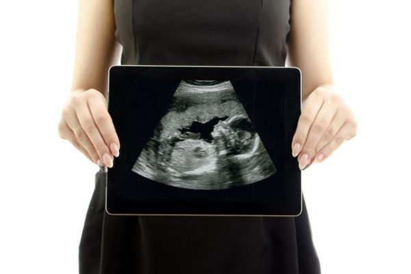 Advanced Maternal Age: Pregnancy After 35