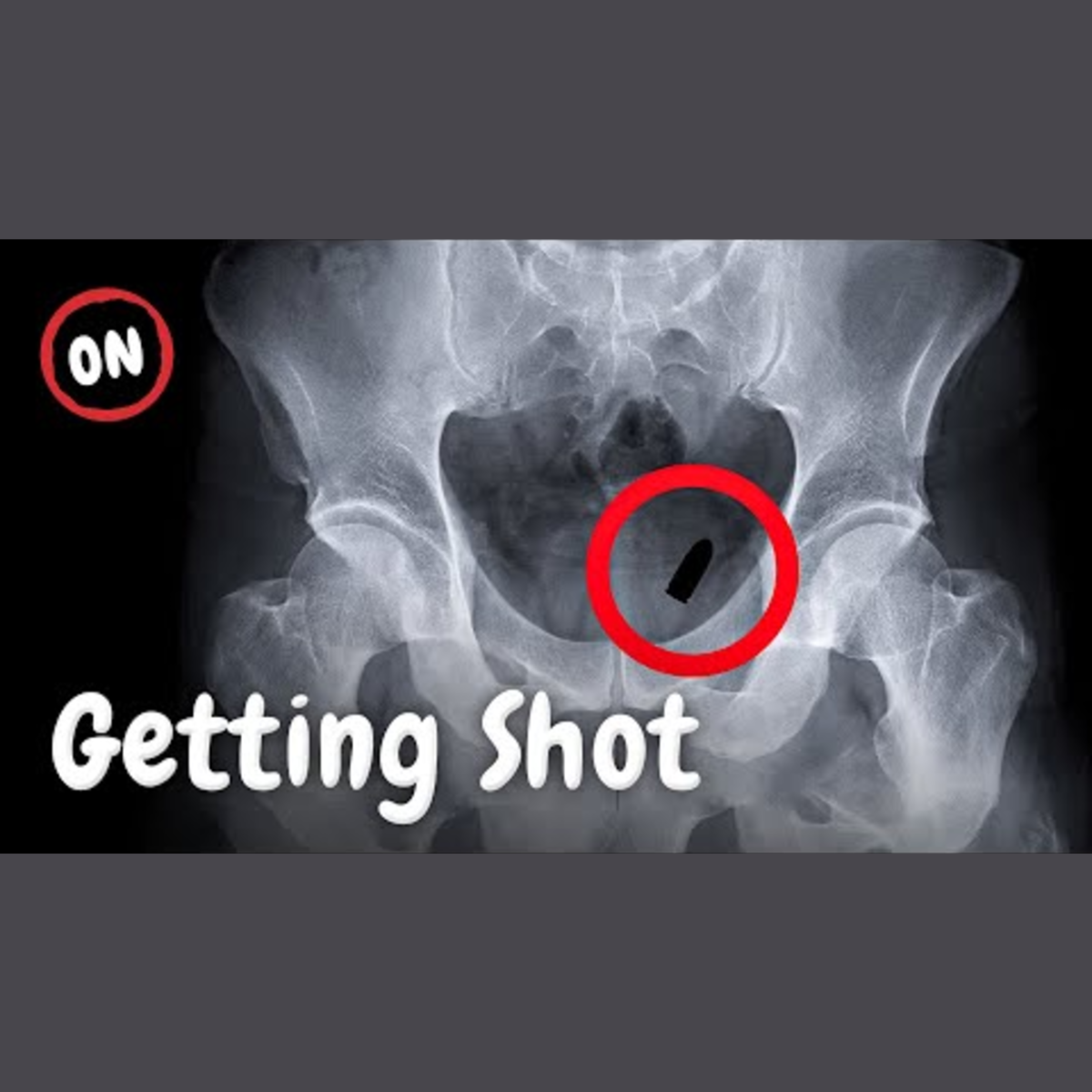 What Happens When You're Shot? episode artwork