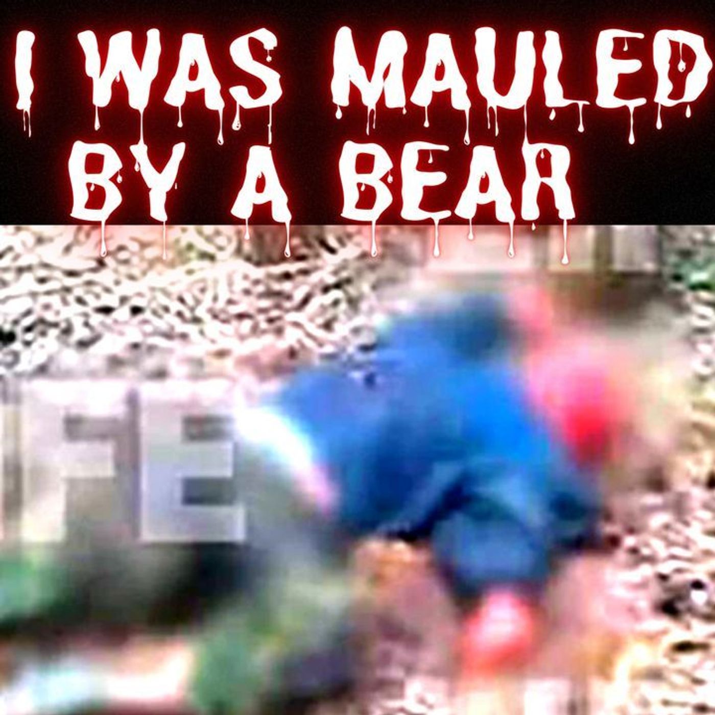 I was mauled by a bear, fought it off, and drove 4 miles down a mountain with my face hanging off. episode artwork