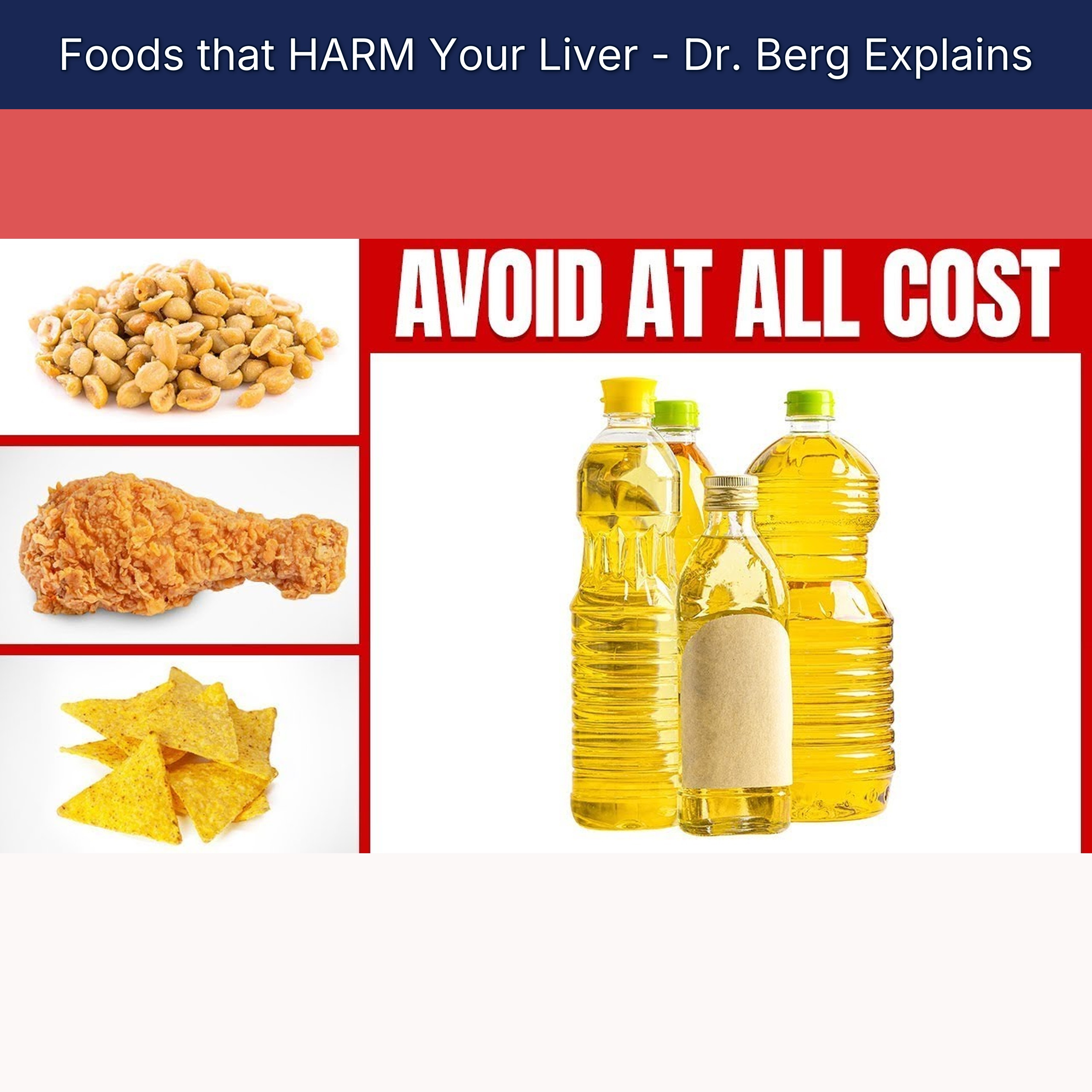 Foods that HARM Your Liver - Dr. Berg Explains episode artwork
