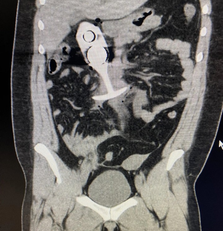 Do Not Bring Your Butt Plug to an MRI scan episode artwork