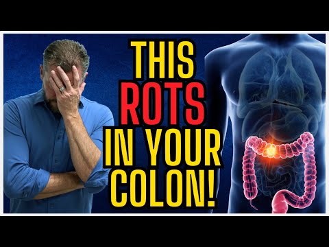 7 Things Rotting in Your Colon Right Now [What Rots in Your Colon?] 2026