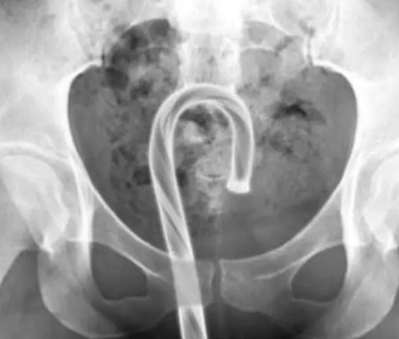 Doctors Warns to Stop Masturbating with Christmas Decor