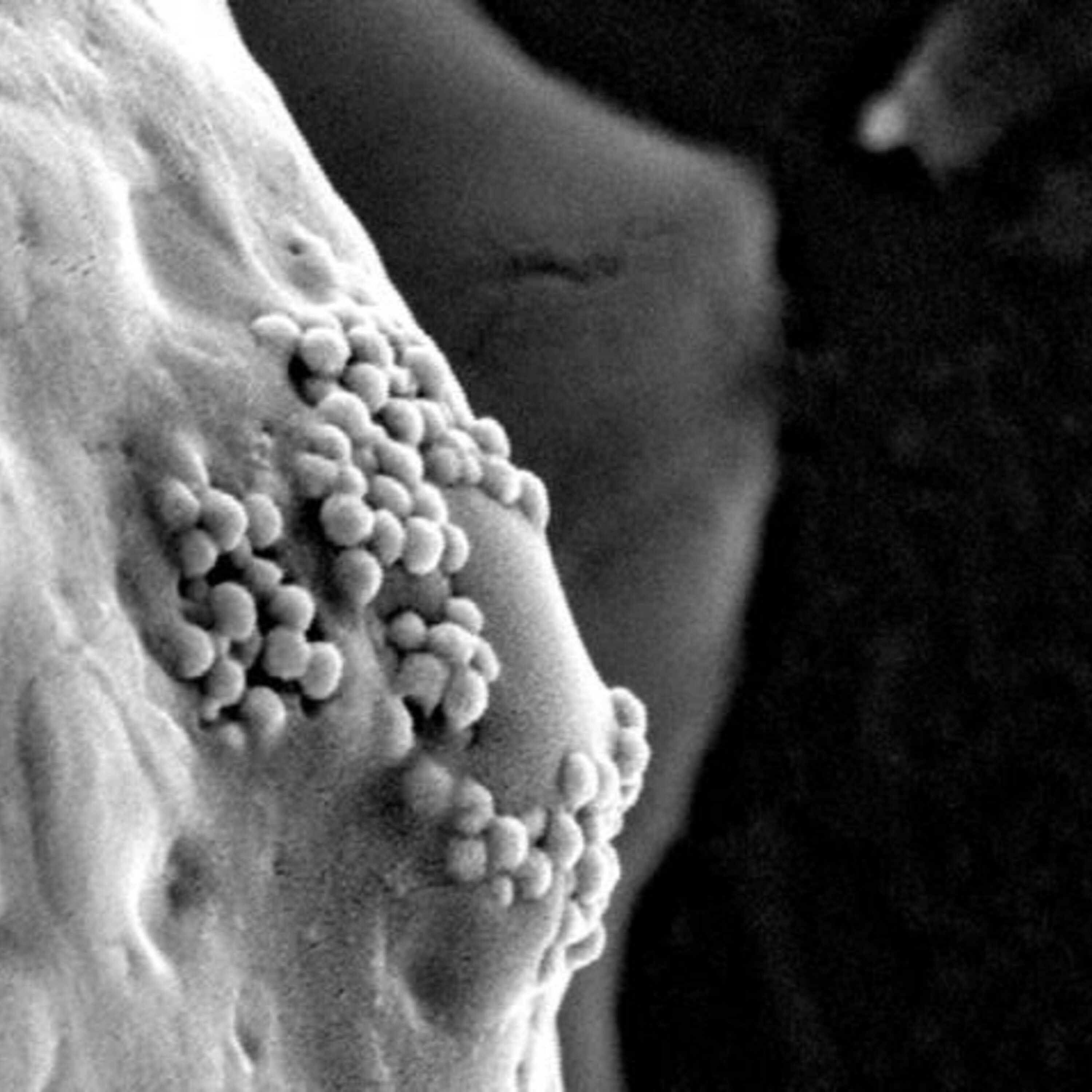 Podcast: Combatting malnutrition with gut microbes, fighting art forgers with science, and killing cancer with gold