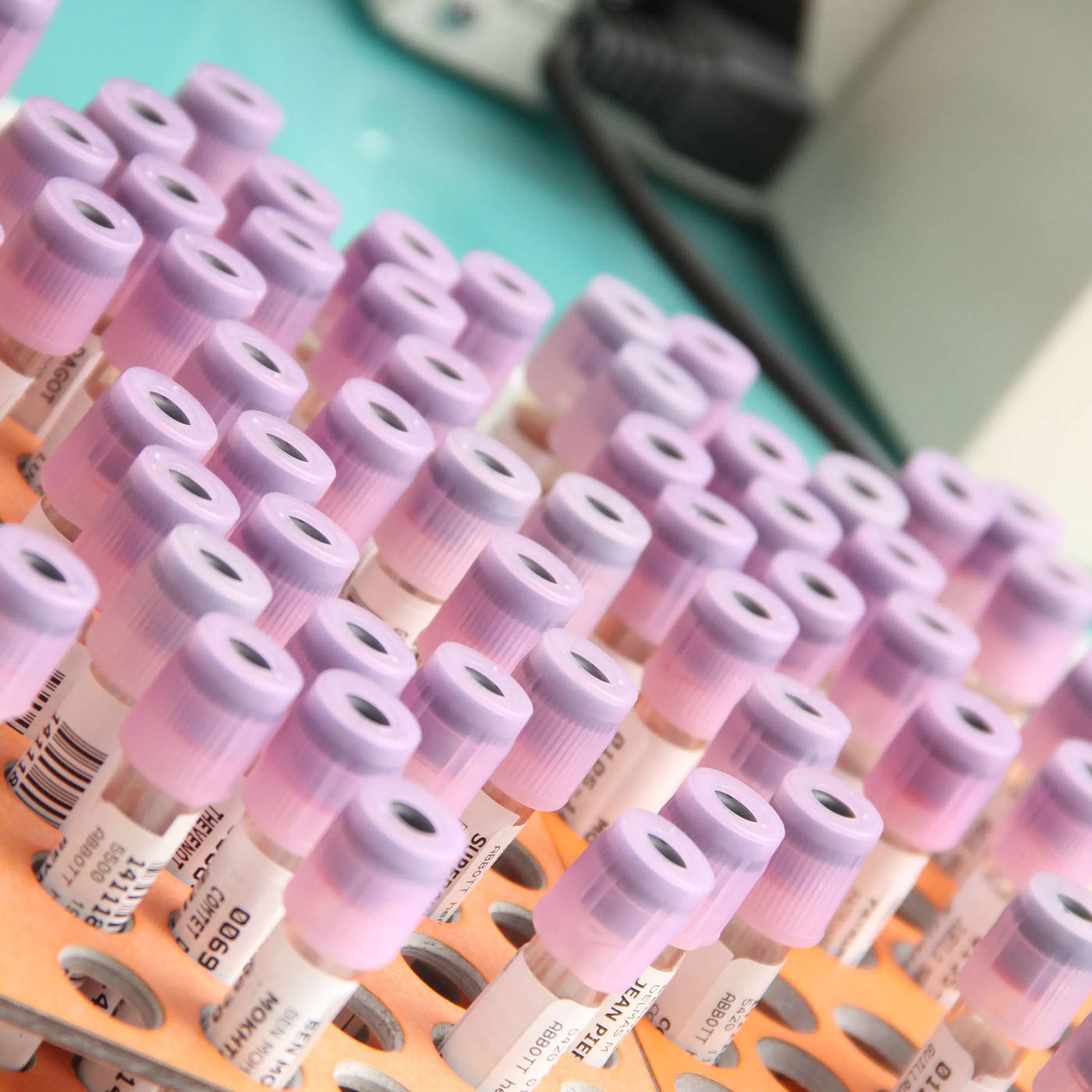 Qu’est-ce que le dépistage massif ?