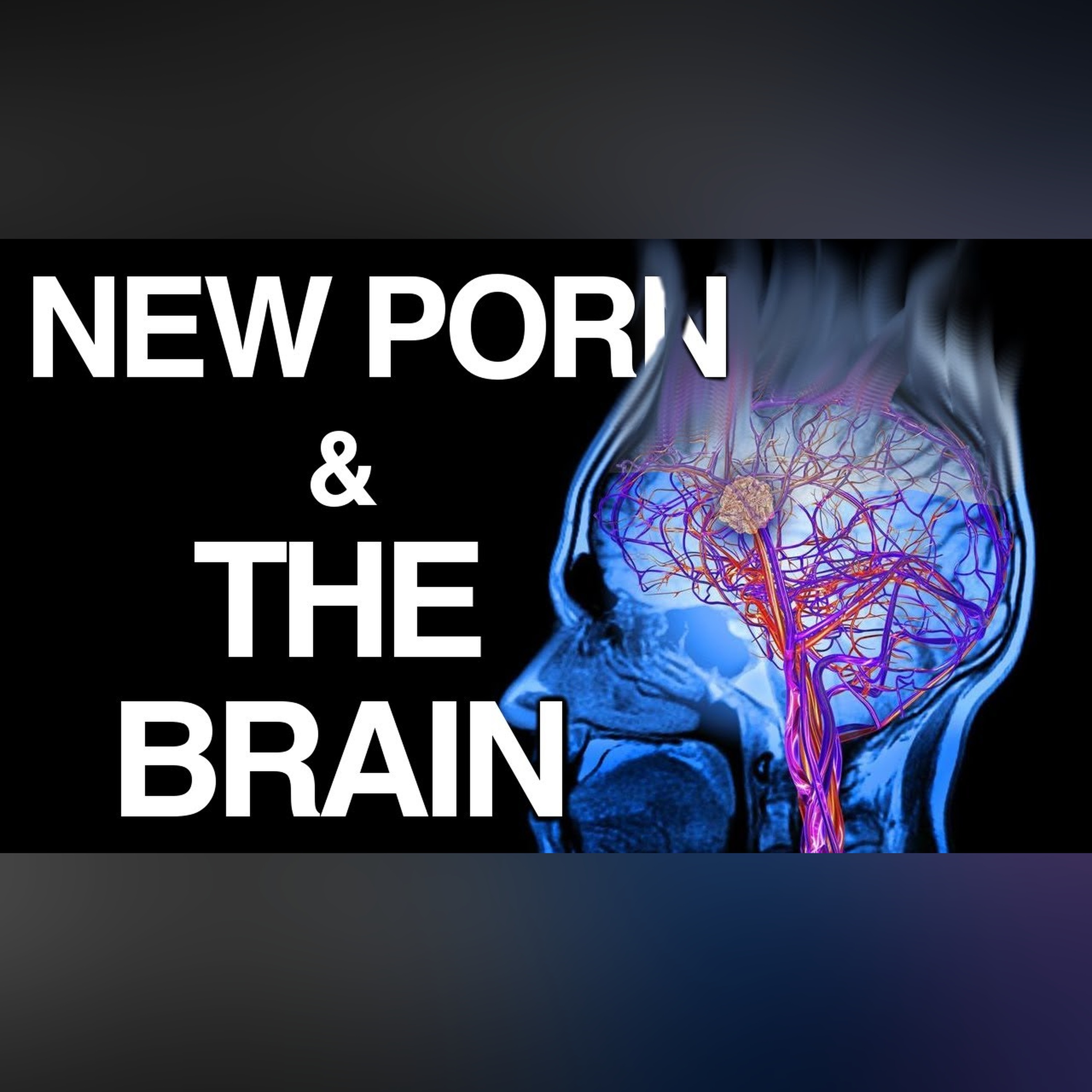 WHY Porn Changes the Brain | Science of NoFap [SFW] episode artwork