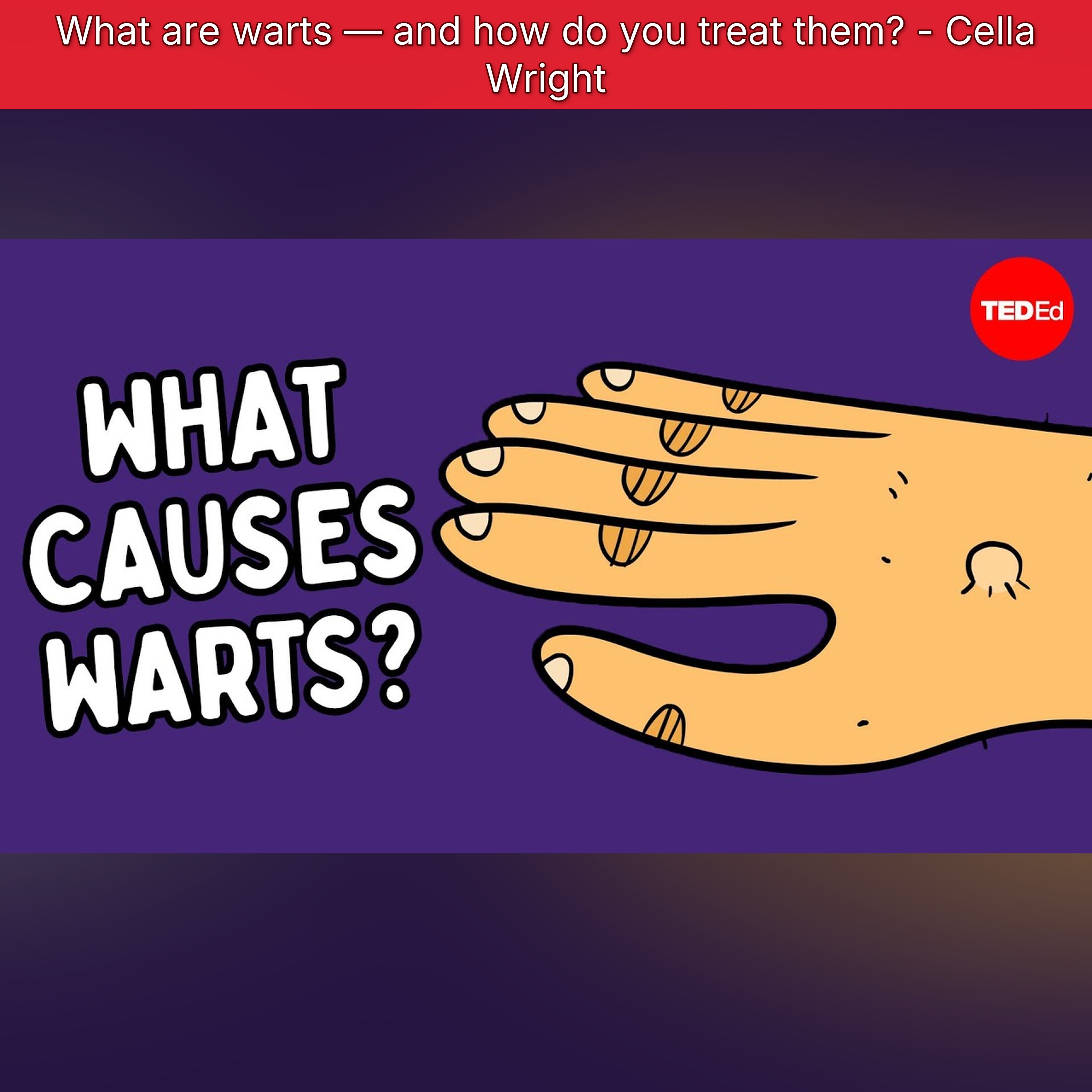 What are warts — and how do you treat them? - Cella Wright episode artwork