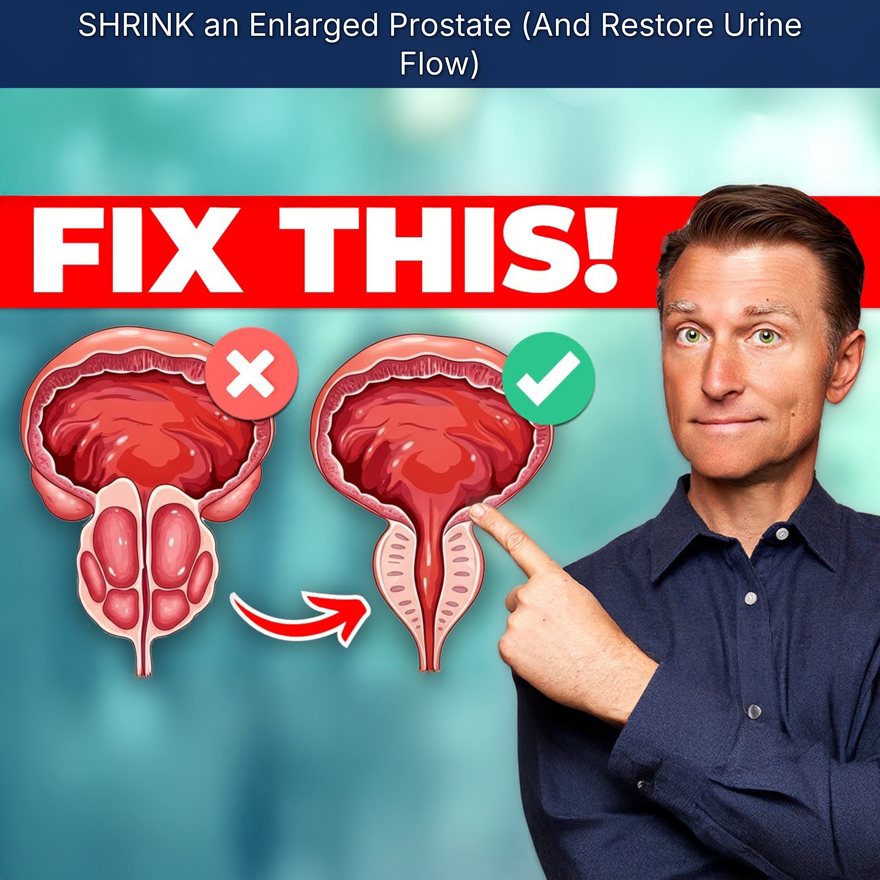 SHRINK an Enlarged Prostate (And Restore Urine Flow)