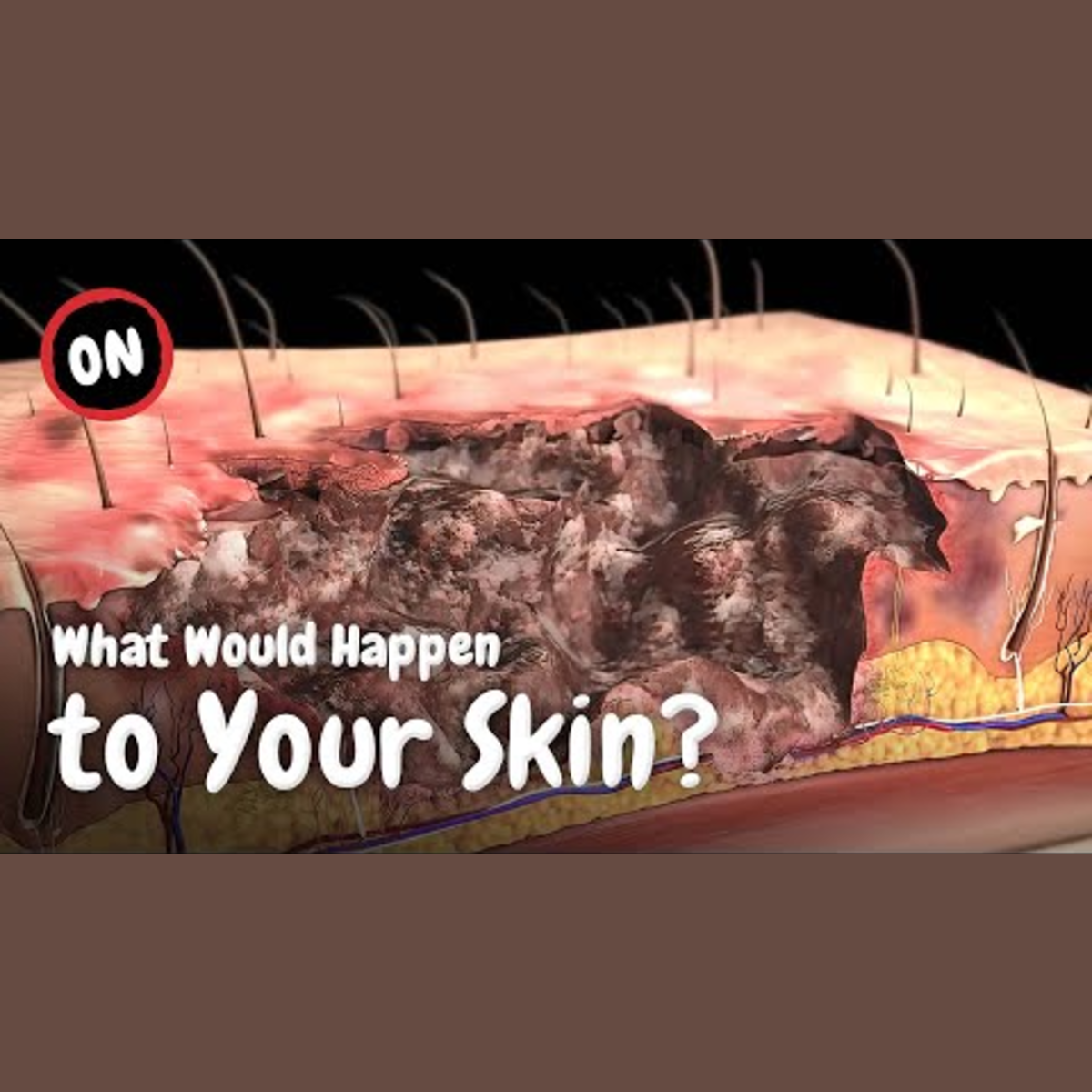 Impact of Daily Tanning on Your Skin episode artwork