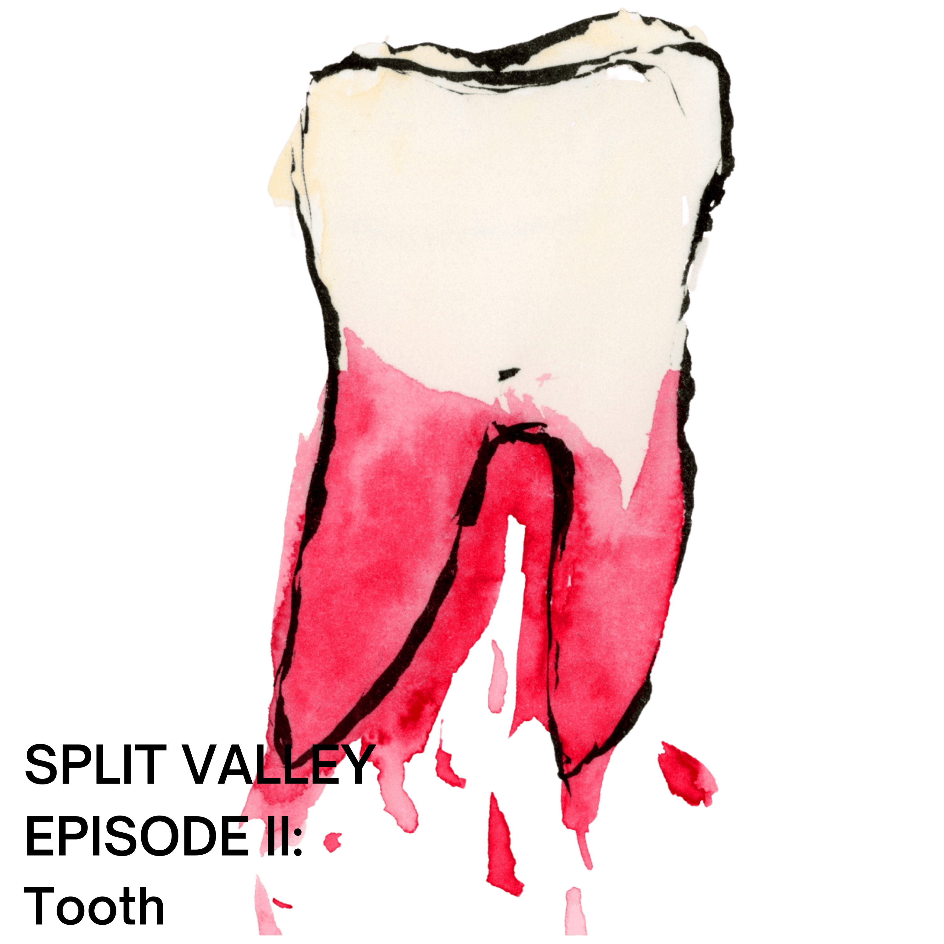 Episode II: Tooth