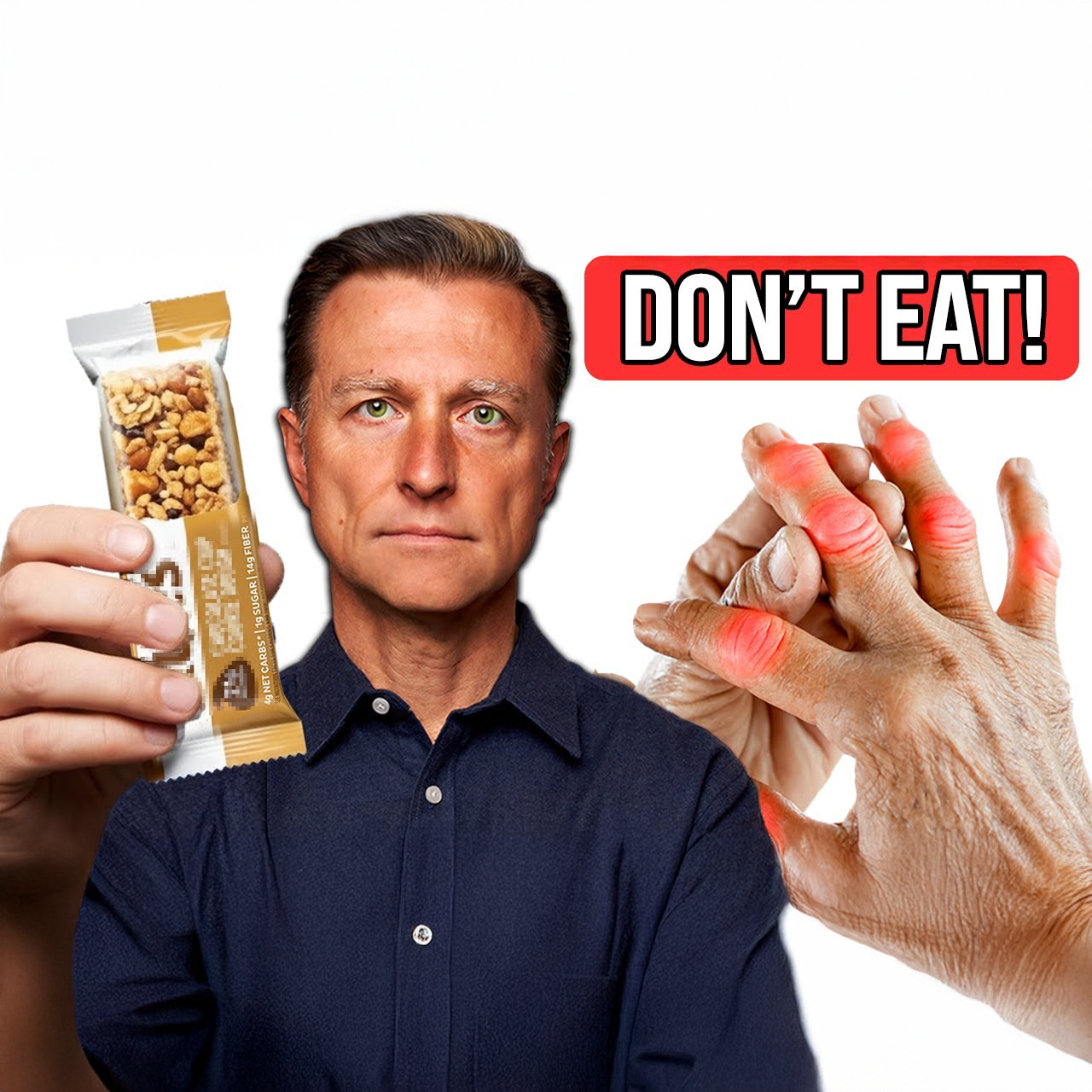 STOP Eating These 7 Foods if You Have Arthritis (& What to Eat Instead)