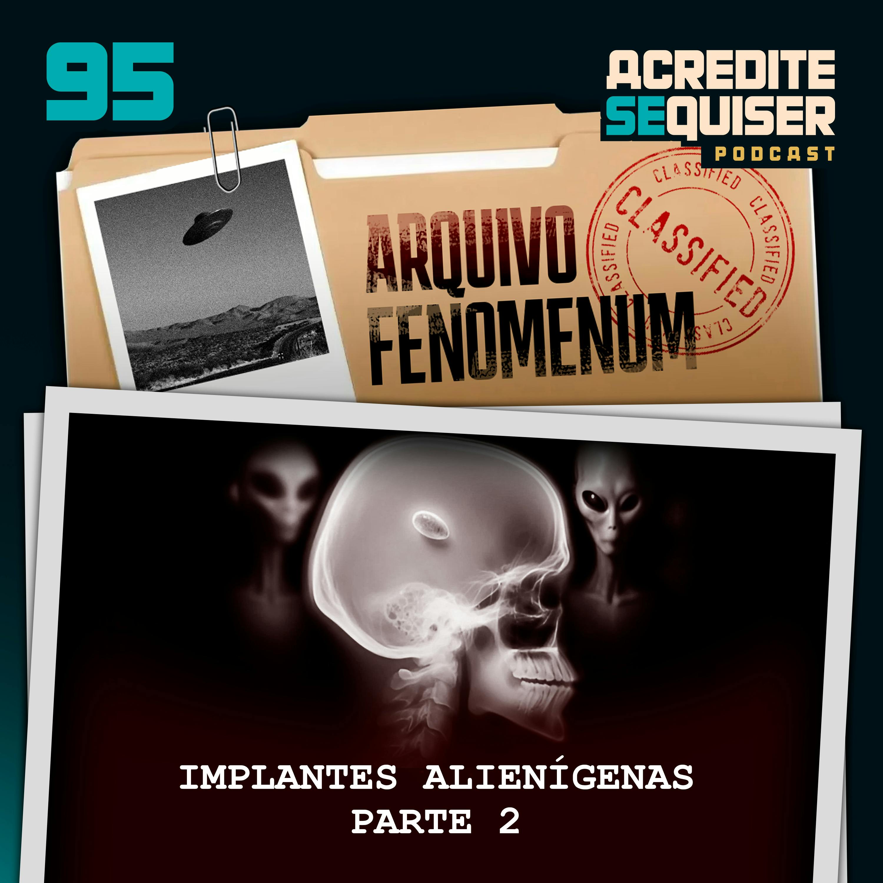 95 - Implantes Alienígenas - Parte 2 95 - Implantes Alienígenas - Parte 2
