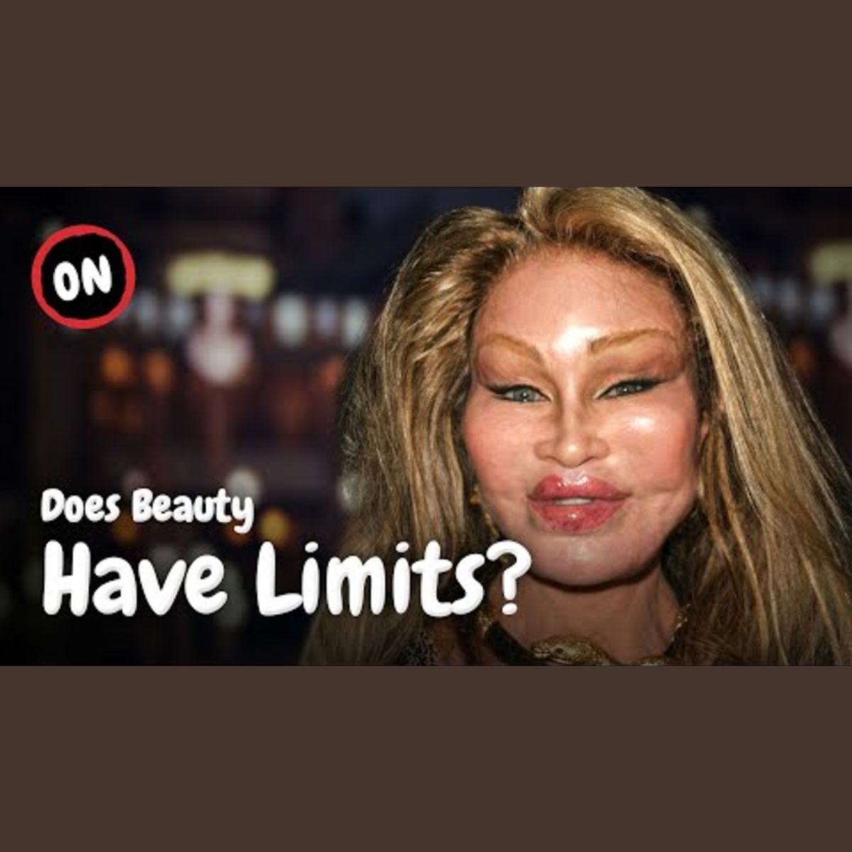 The Risks of Excessive Botox Injections episode artwork