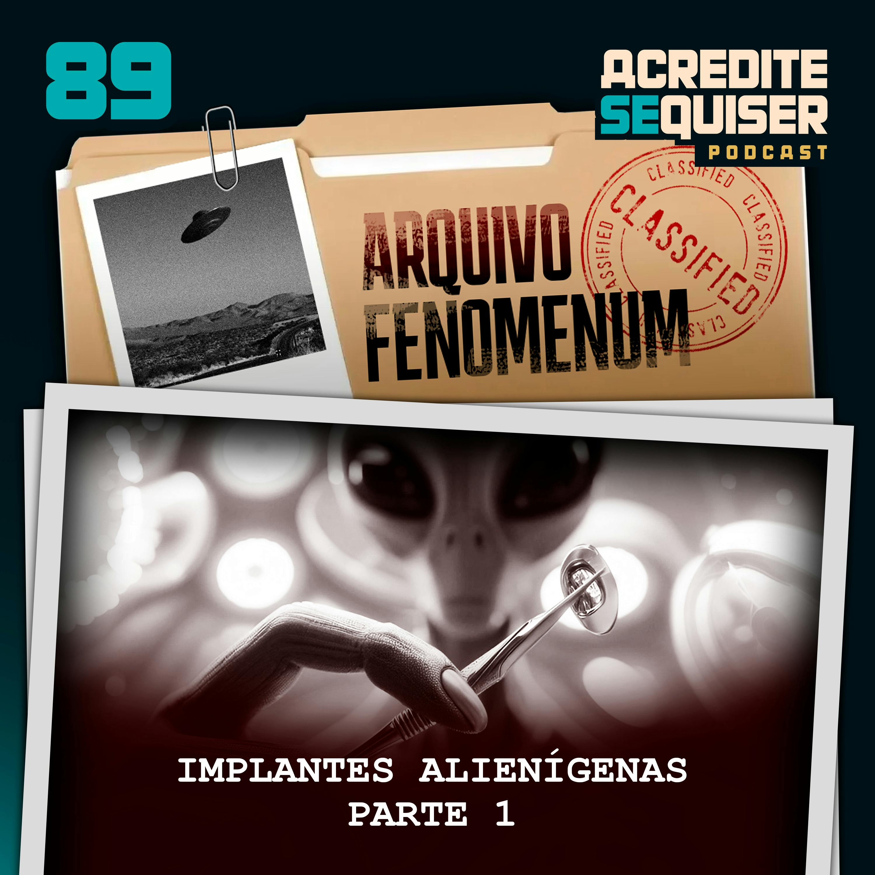 89 - Implantes Alienígenas - Parte 1 89 - Implantes Alienígenas - Parte 1
