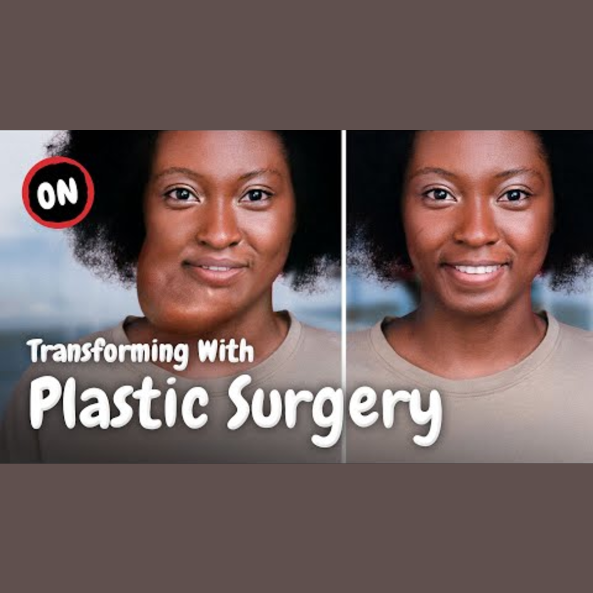How Reconstructive Surgery Transformed Lives episode artwork